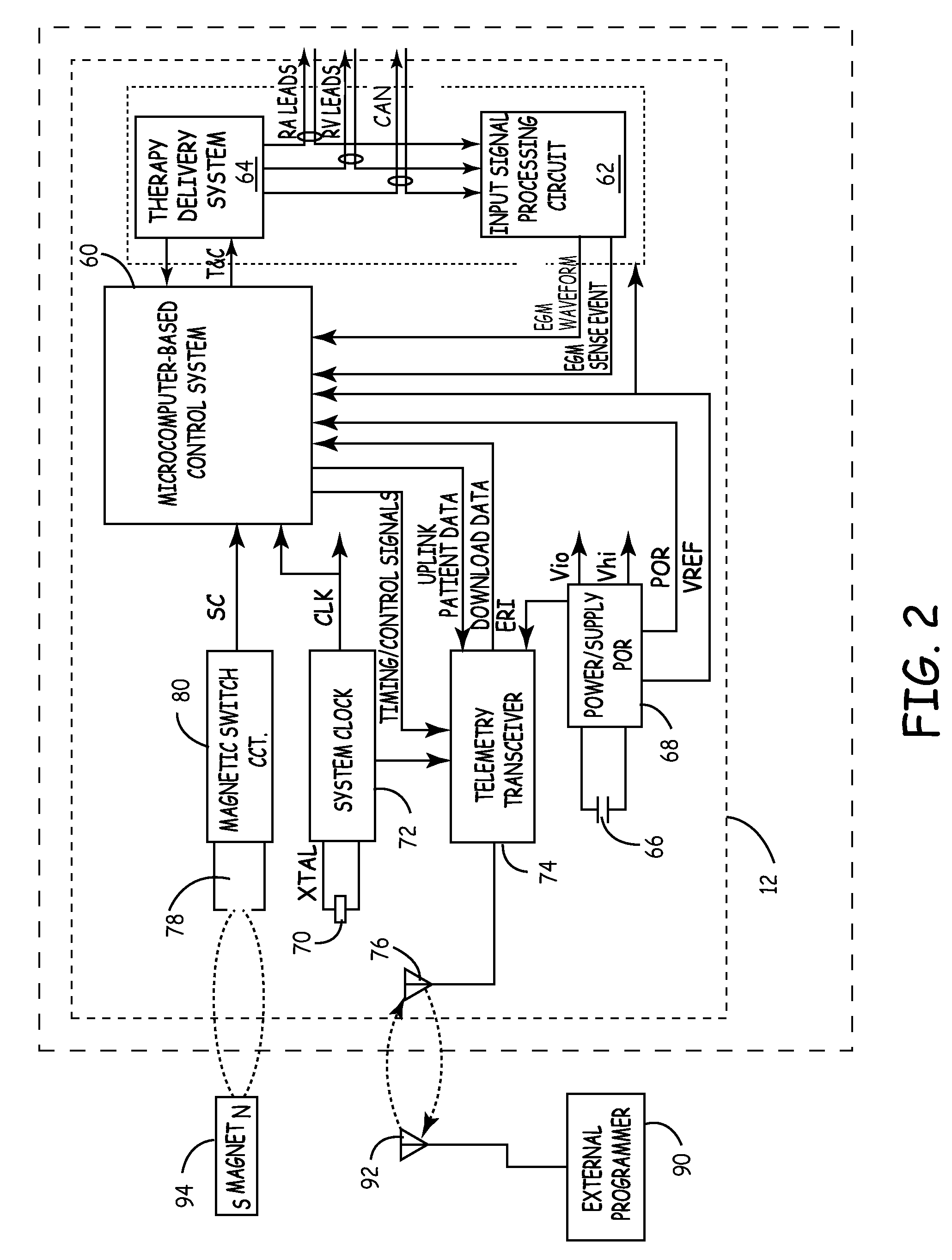 Implantable cardioverter defibrillator with automatically adaptable sensing configuration