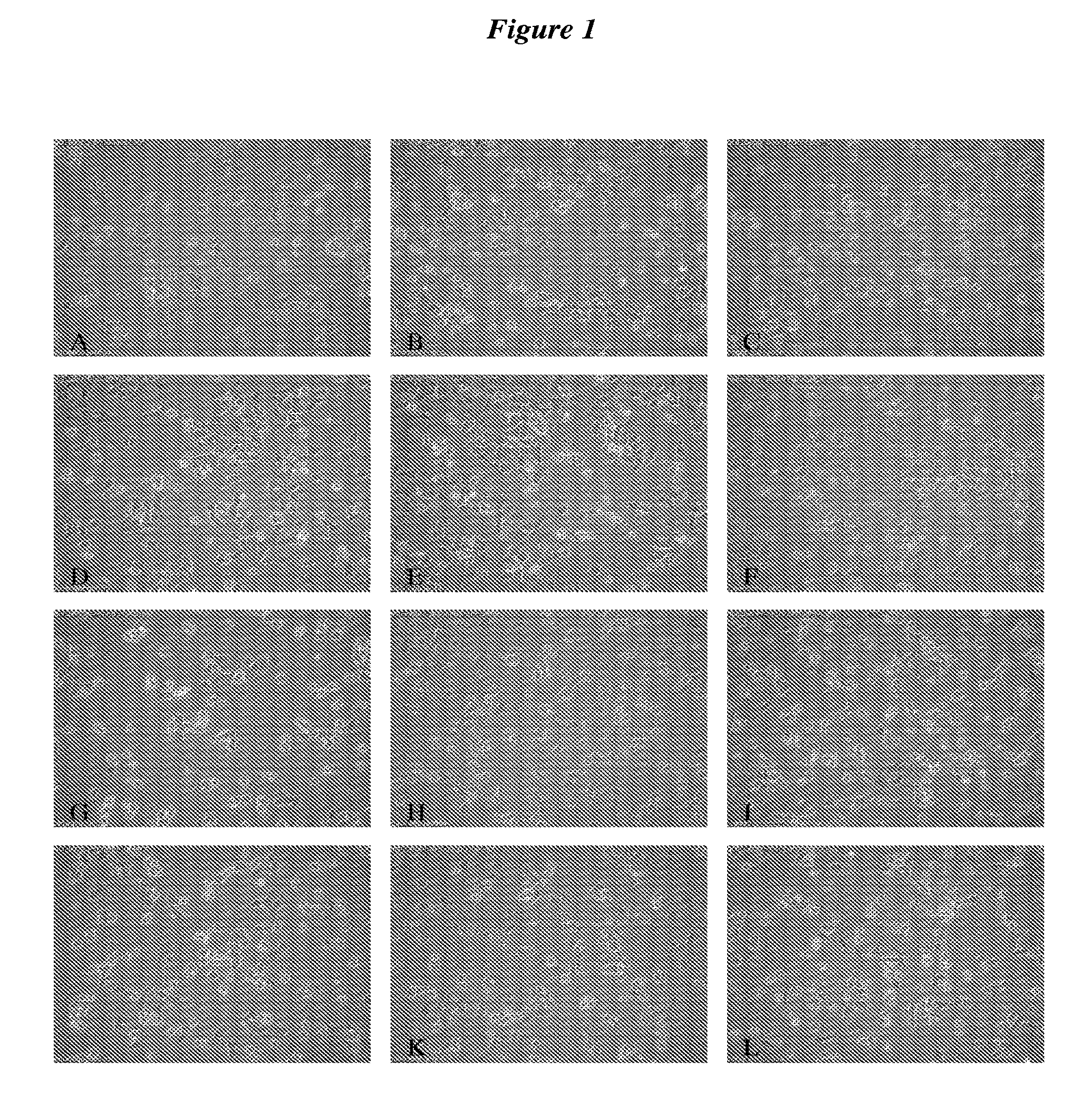 Methods for treatment of a sarcoma using an epimetabolic shifter (coenzyme q10)