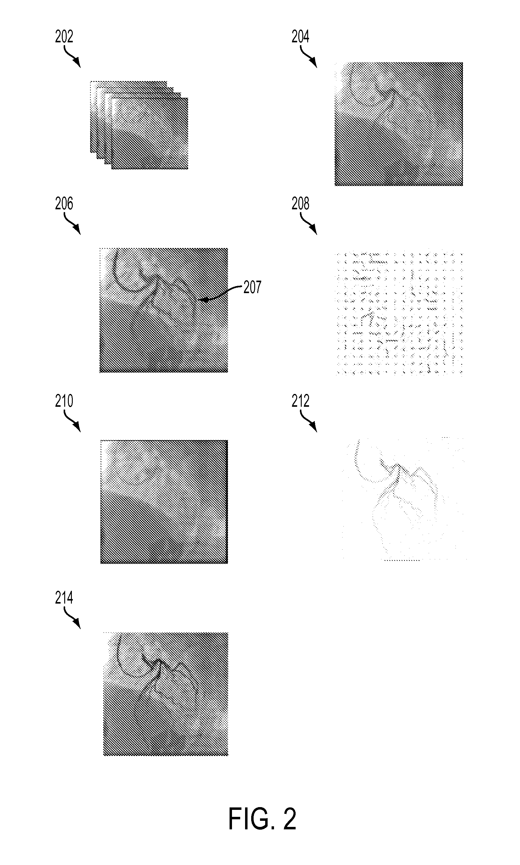 System and method for coronary digital subtraction angiography