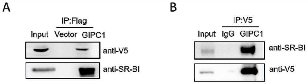 SiRNA for silencing GIPC1 gene, recombinant vector and application of siRNA and recombinant vector