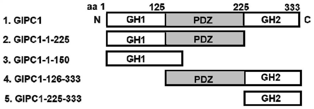 SiRNA for silencing GIPC1 gene, recombinant vector and application of siRNA and recombinant vector