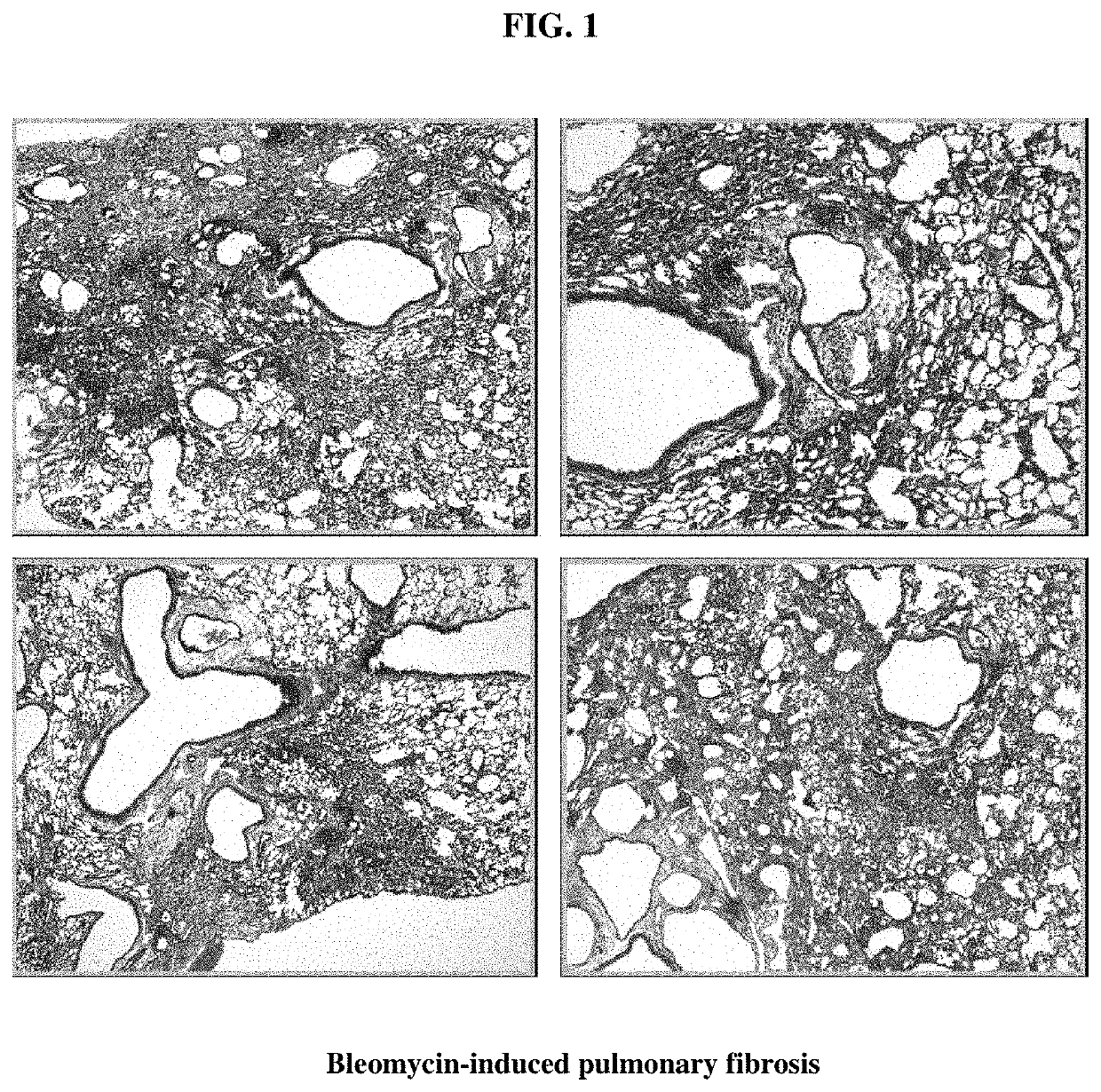 Composition for treating pulmonary fibrosis comprising alloferon