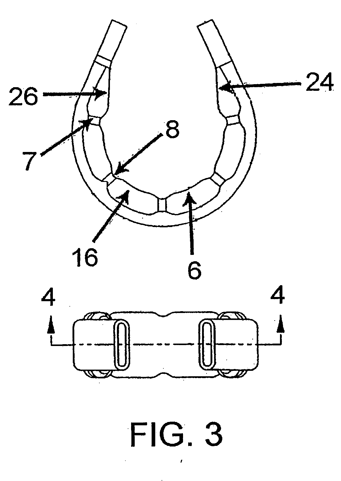 Fatigue-resistant gastric banding device