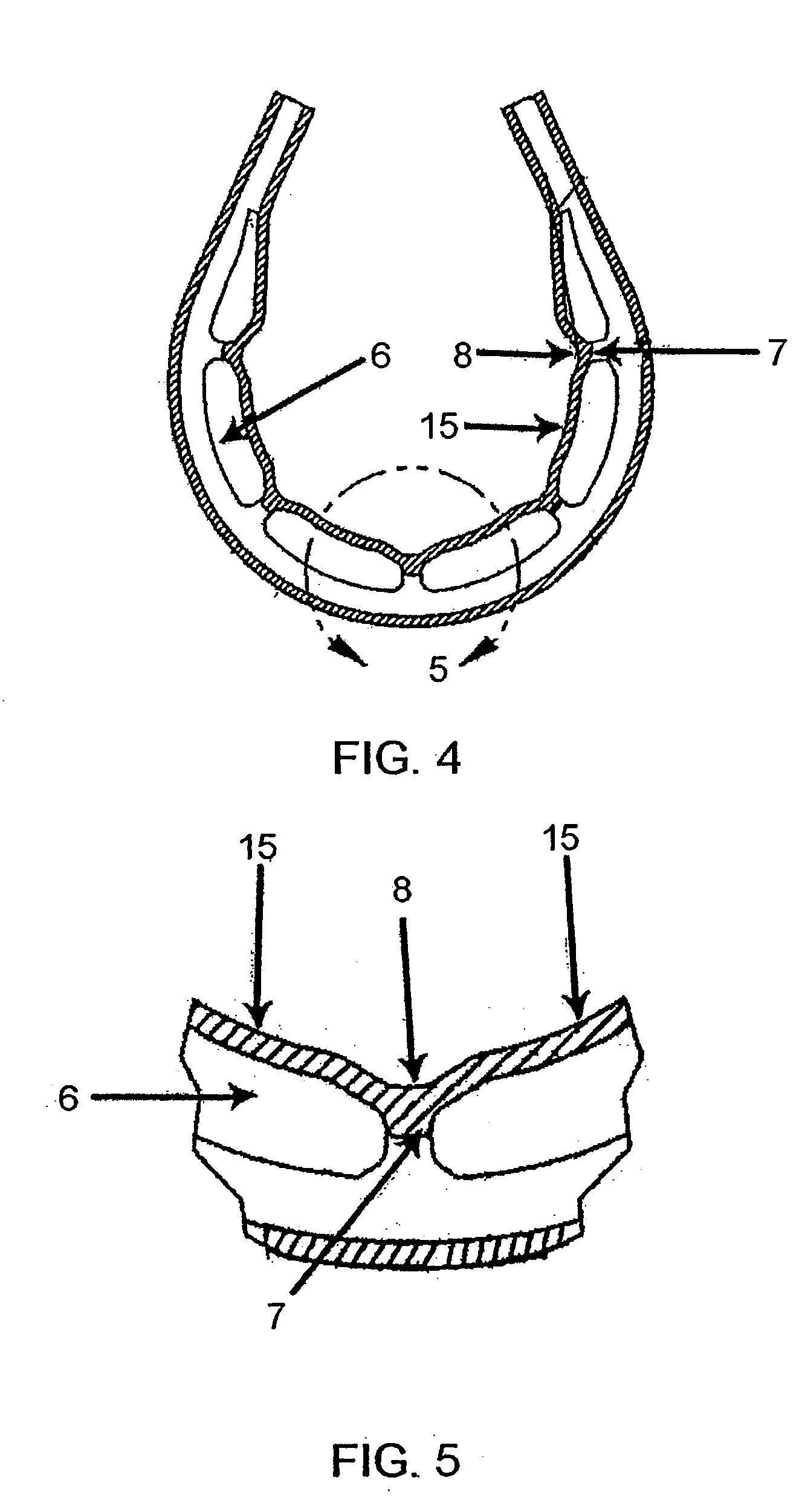 Fatigue-resistant gastric banding device