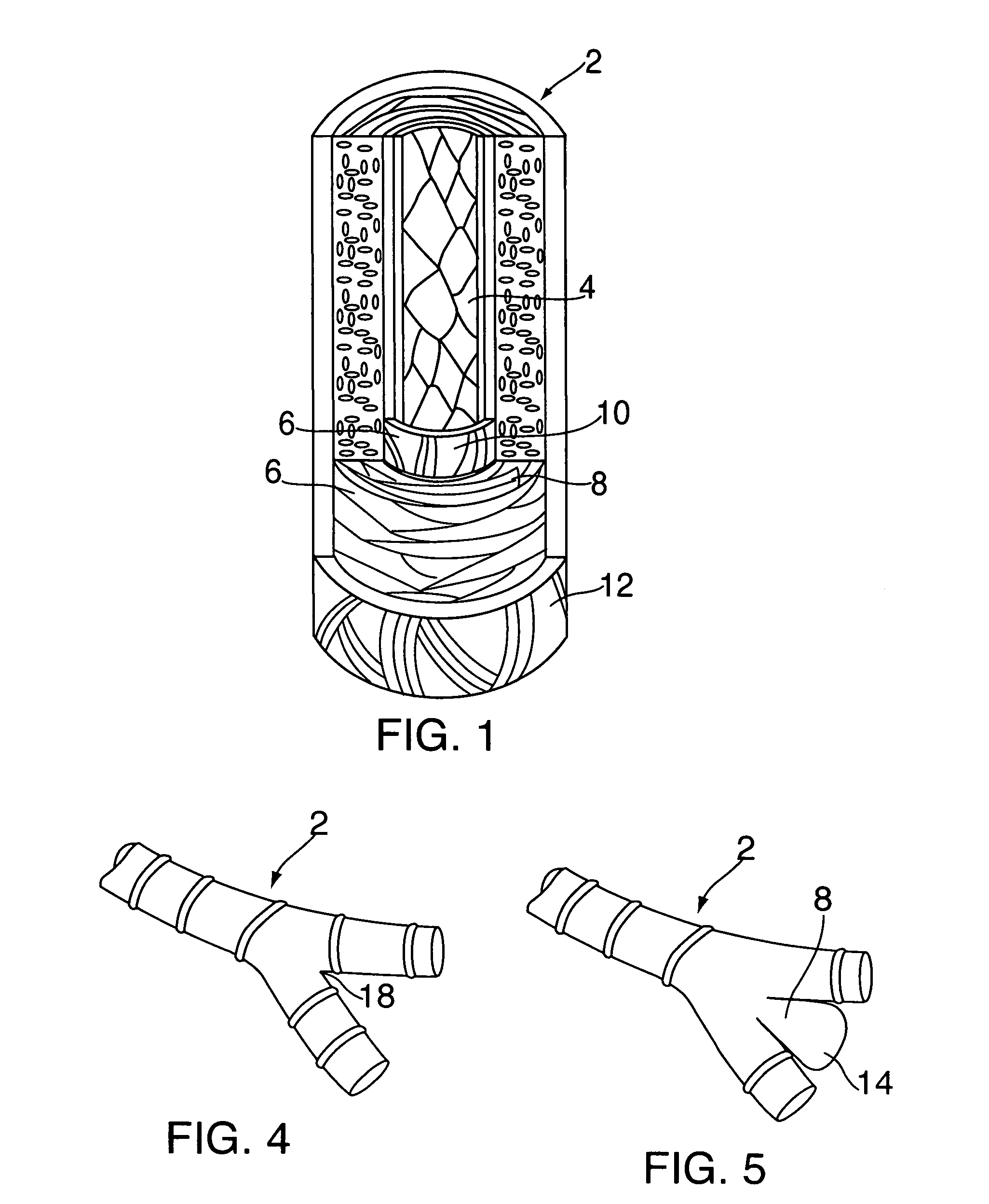 Aneurysm treatment devices and methods