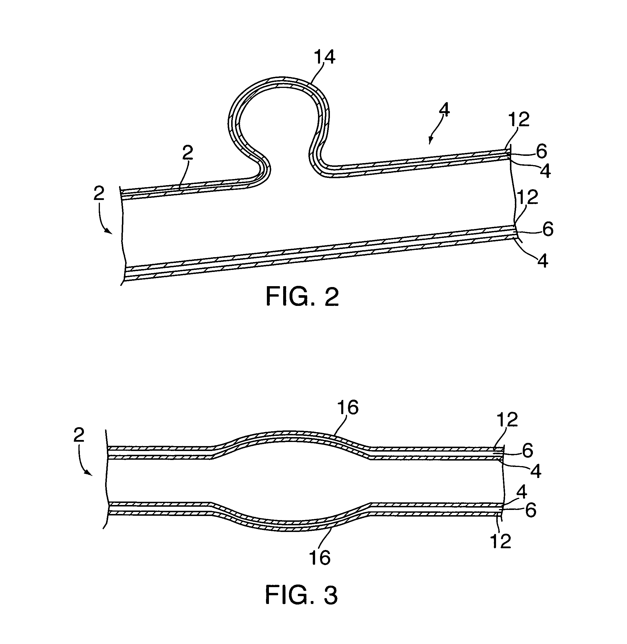 Aneurysm treatment devices and methods