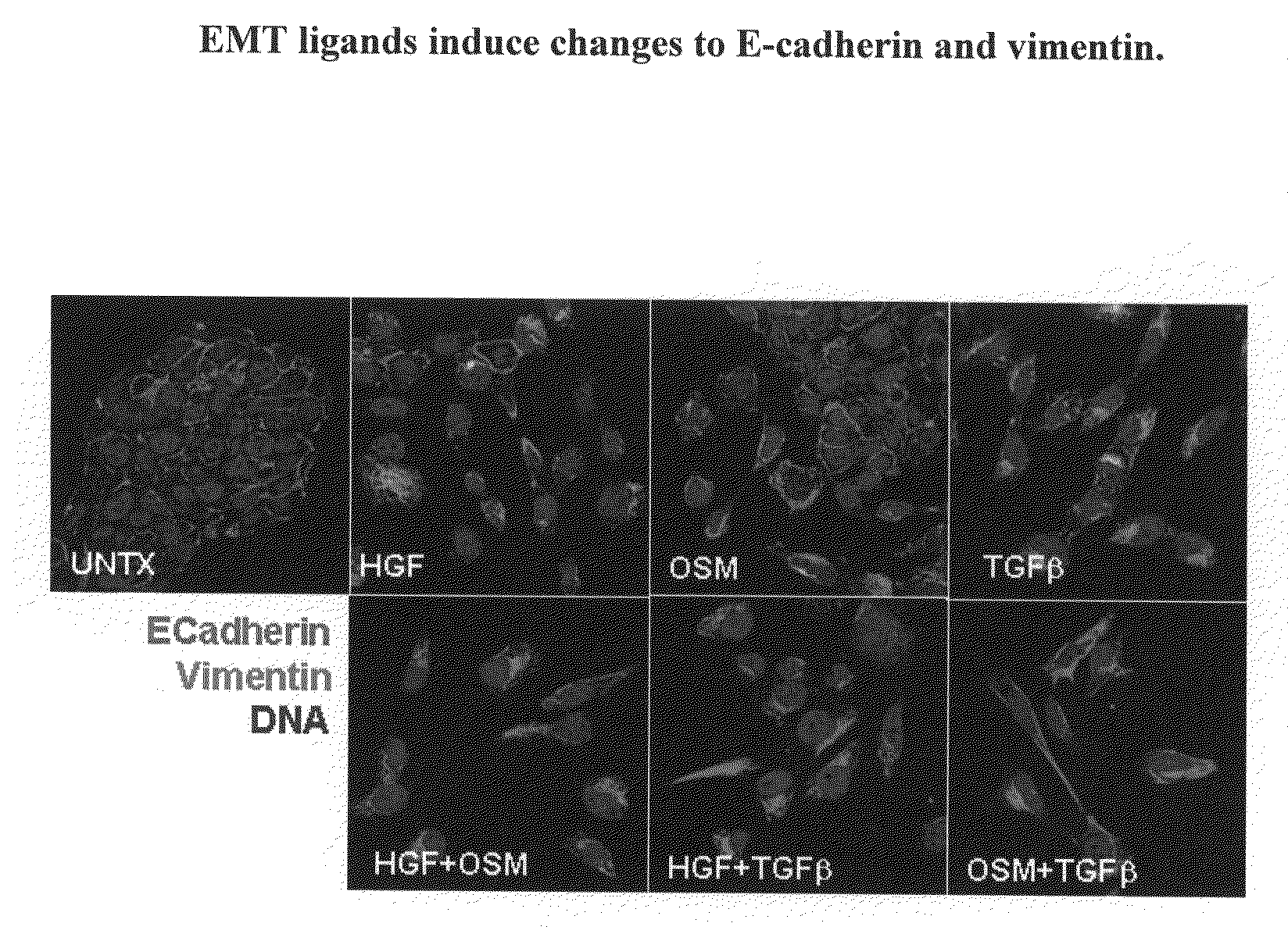 Methods for the identification of agents that inhibit mesenchymal-like tumor cells or their formation