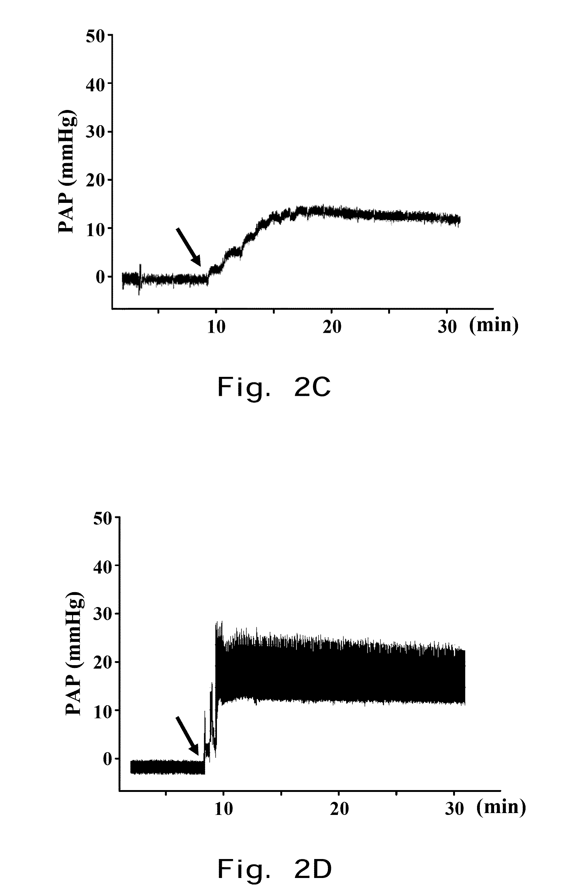 INHALED NO DONOR PIPERAZINYL DERIVATIVE PREVENTING ALLERGIC PULMONARY VASCULAR AND BRONCHIAL INFLAMMATION BY REDUCING VEGF AND RESTORING eNOS IN HYPOXIC PULMONARY ARTERY