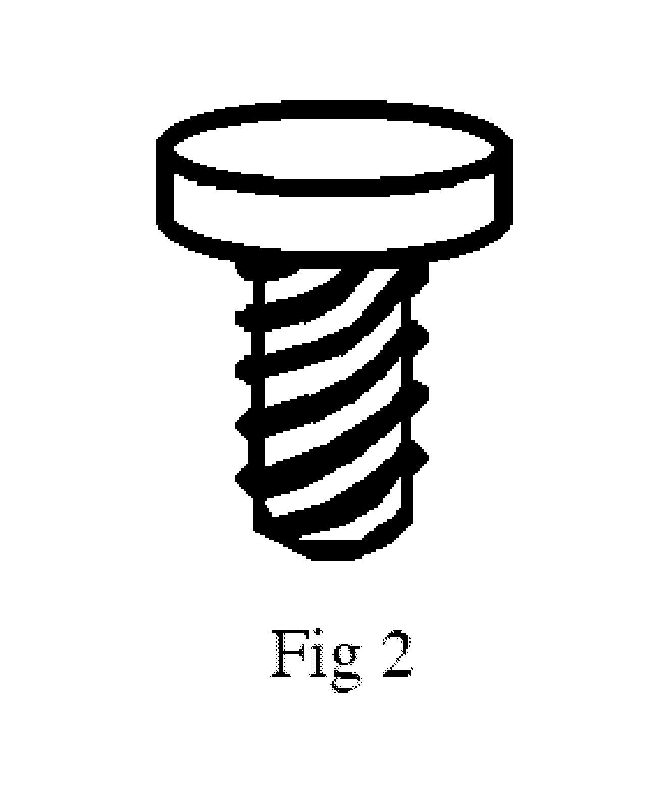 Hole-Less Editable Binding System