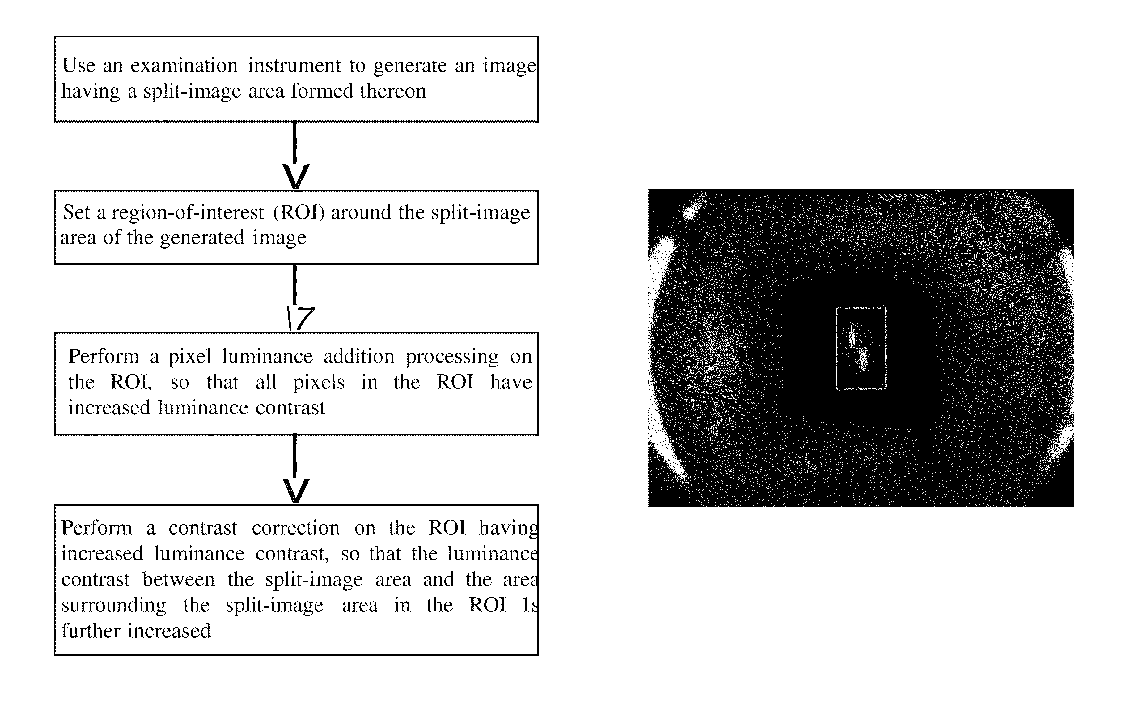 Image-recognition method for assisting ophthalmic examination instrument