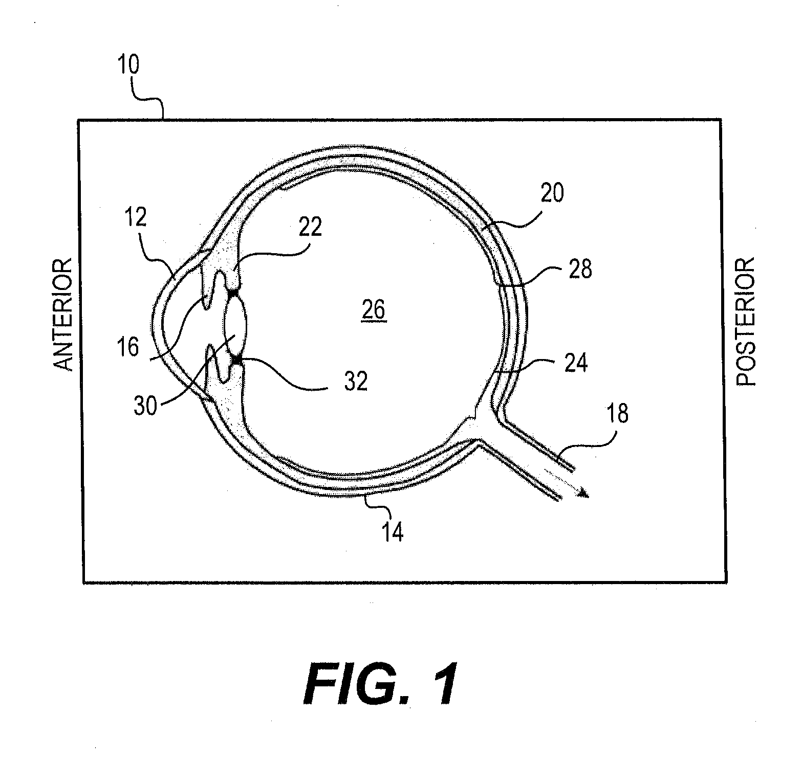 Modular intraocular lens designs, tools and methods