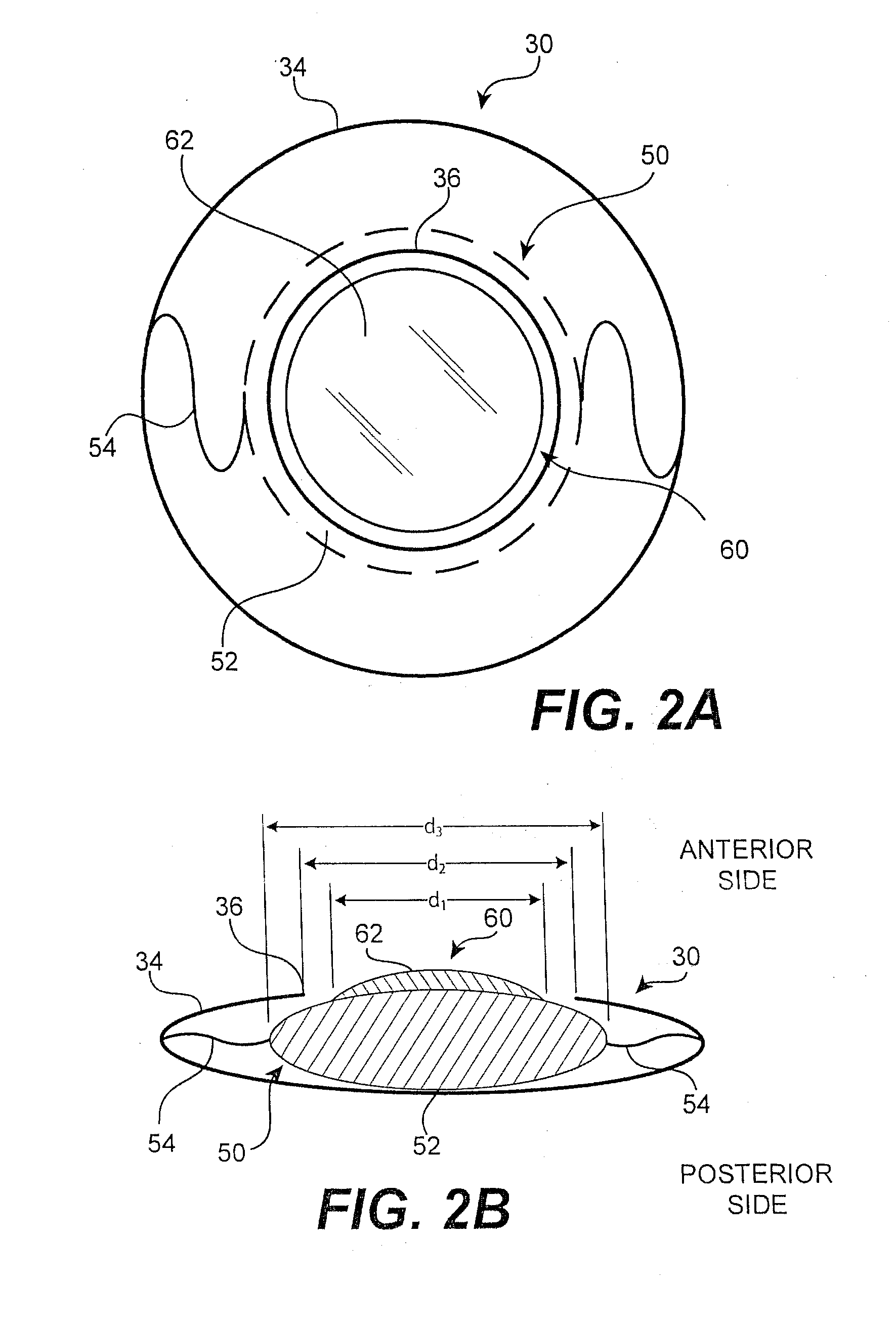 Modular intraocular lens designs, tools and methods