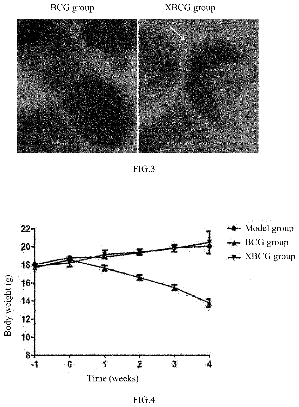 Tuberculosis vaccine, preparation method therefor, and use thereof