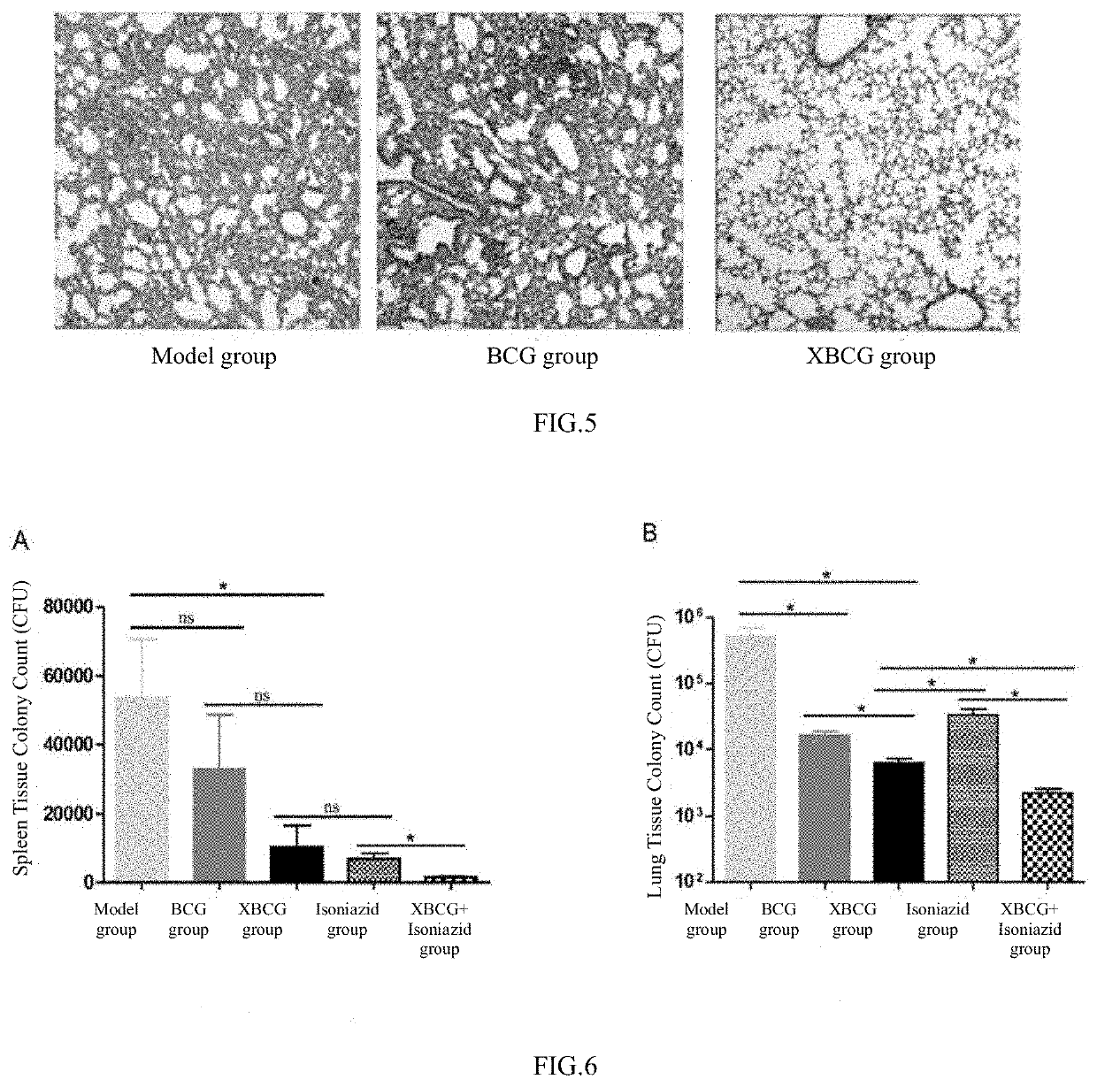 Tuberculosis vaccine, preparation method therefor, and use thereof