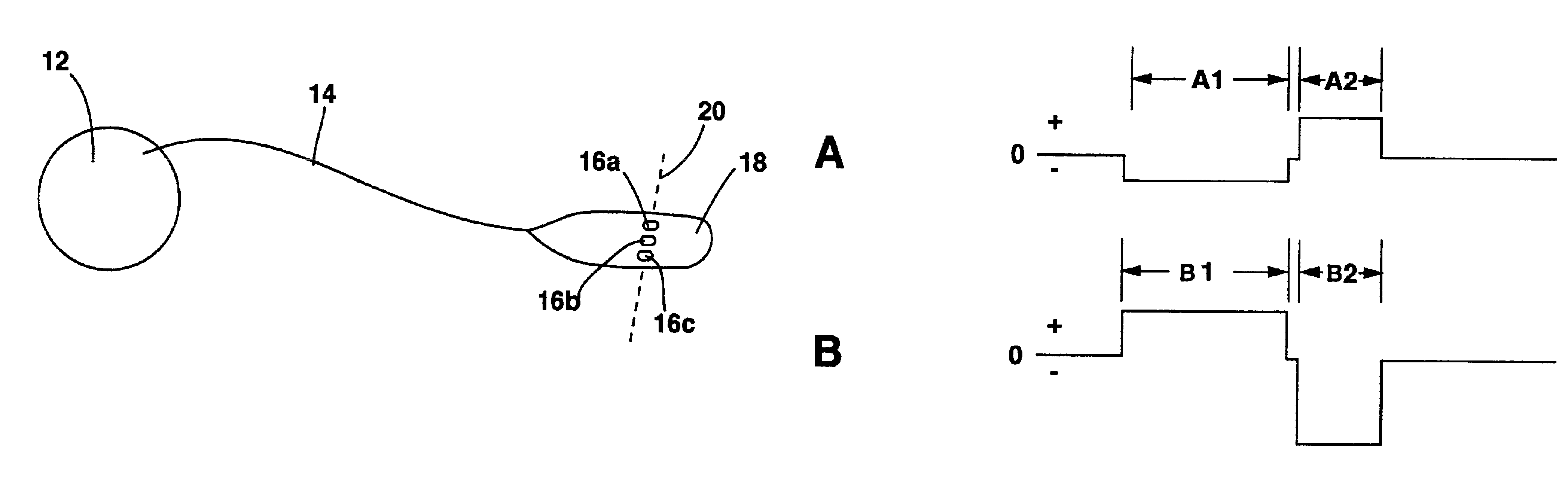 Method of preparing neural tissue of the brain for subsequent electrical stimulation