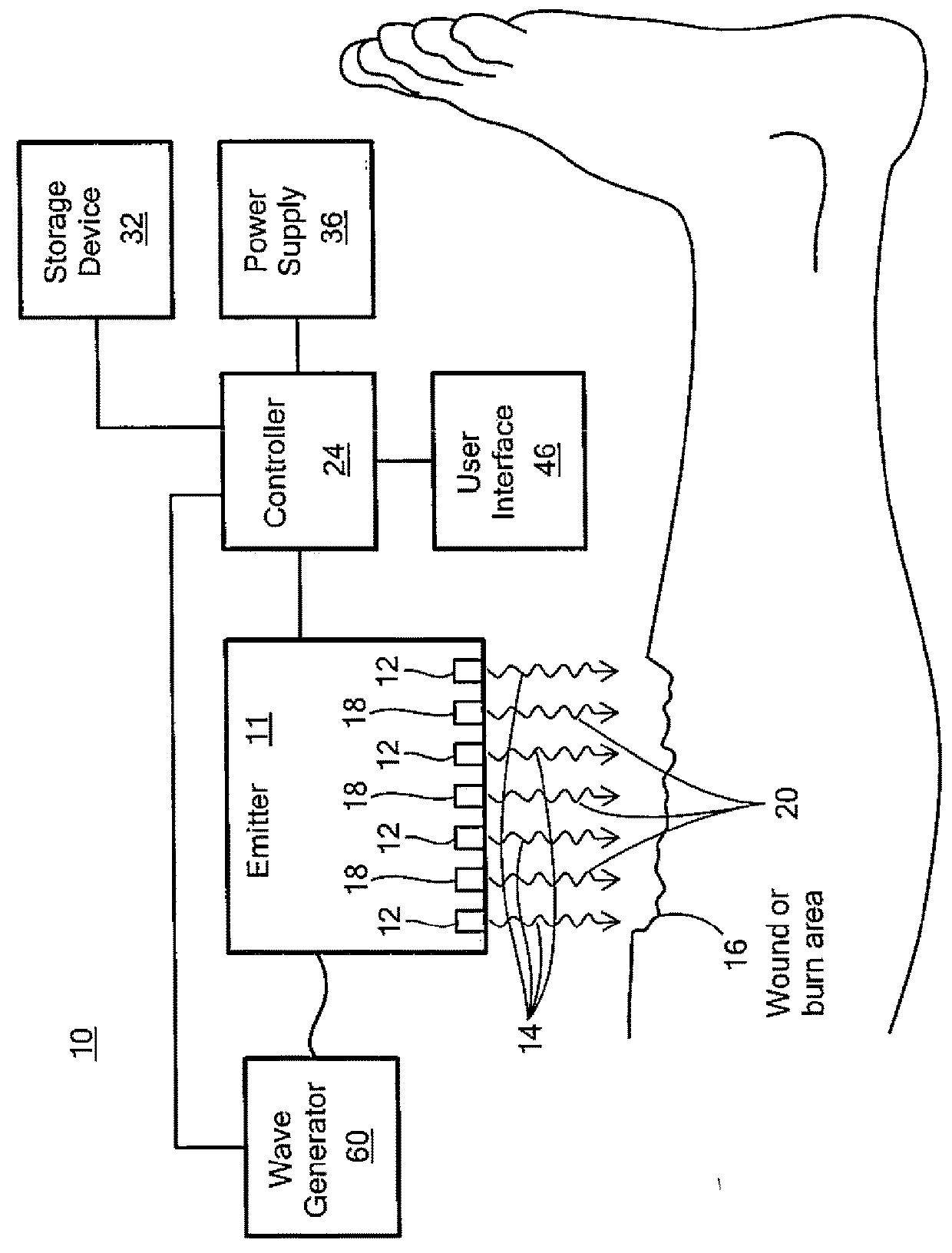 System and Method For Healing and/or Disinfecting Wounds and Burns