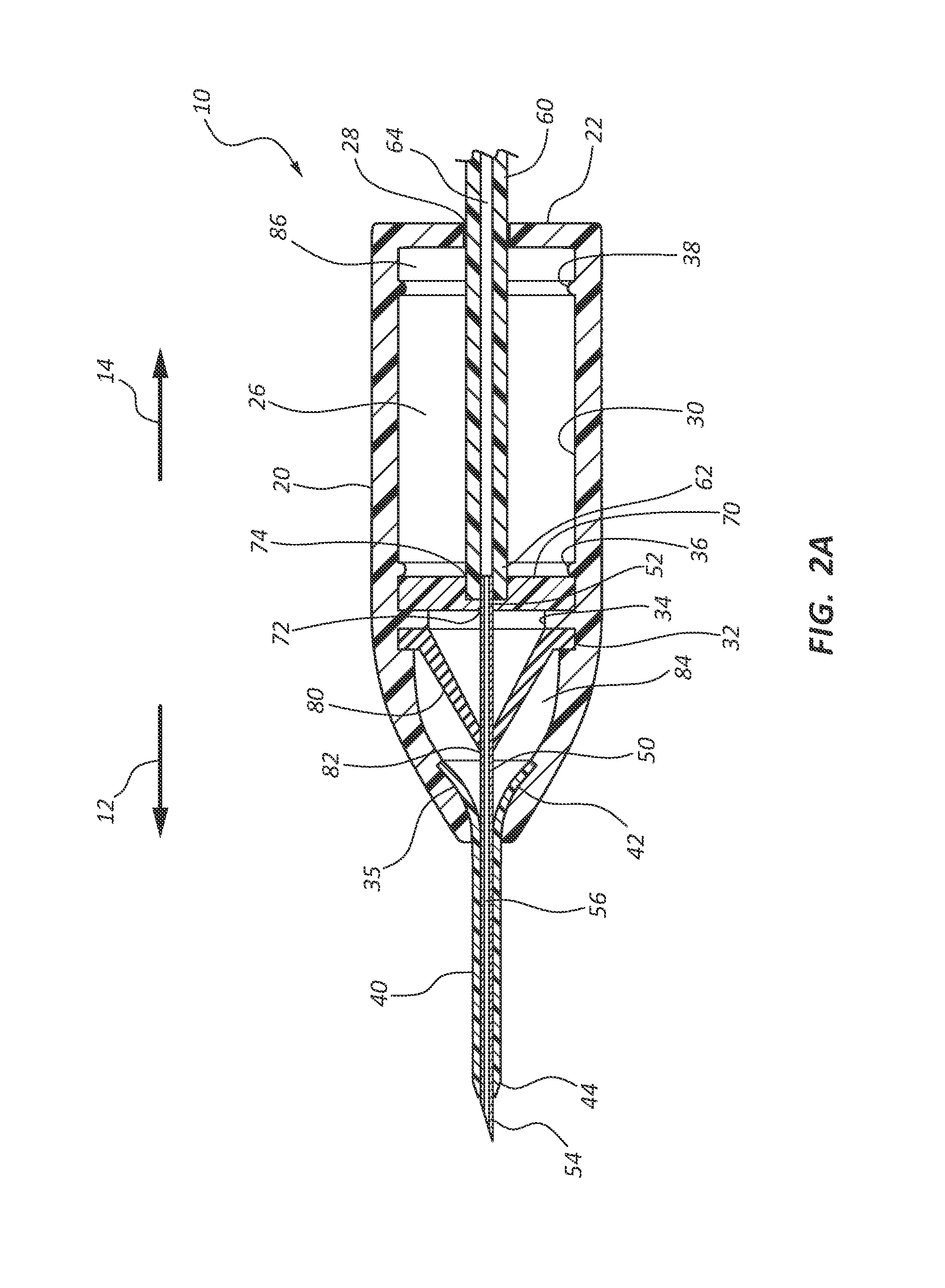 Over-the-needle intravenous catheter assembly with integrated intravenous tubing