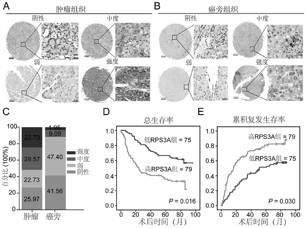 Application of RPS3A molecule in prediction of immune cell infiltration and immune checkpoint molecular expression level in tumors and predicting model