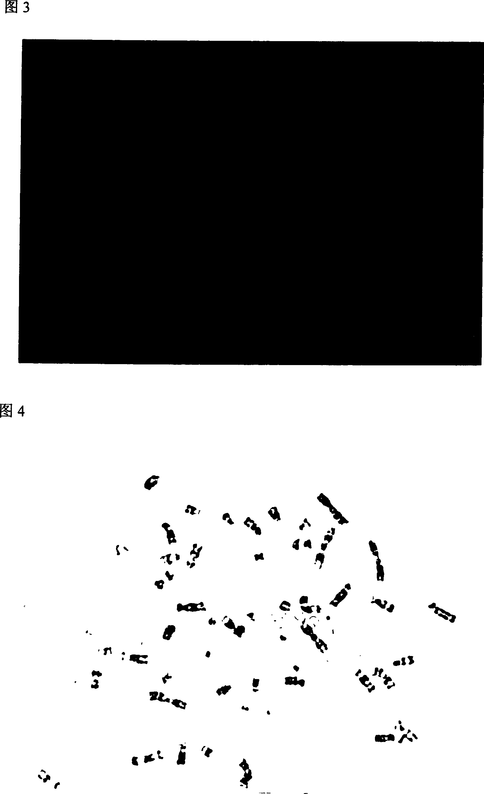 Human lung adenocarcinoma self-transferring cell strain and its construction