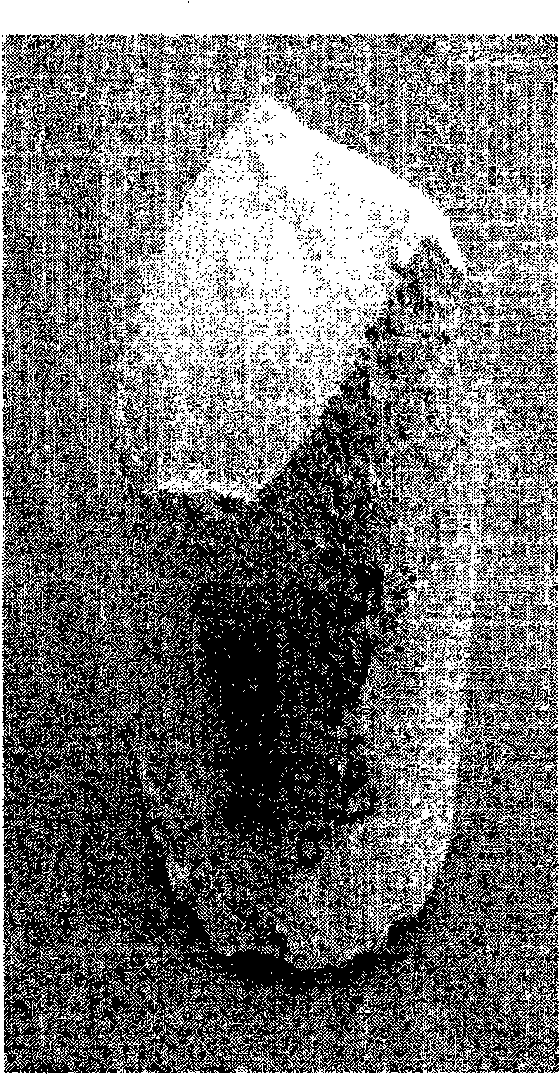 Implants comprising biodegradable metals and method for manufacturing the same