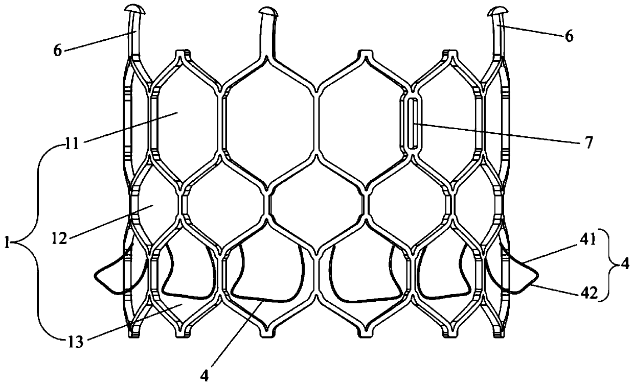 Transcatheter interventional artificial valve