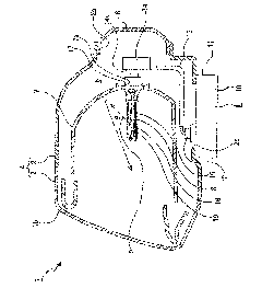 Discharge lamp for vehicle