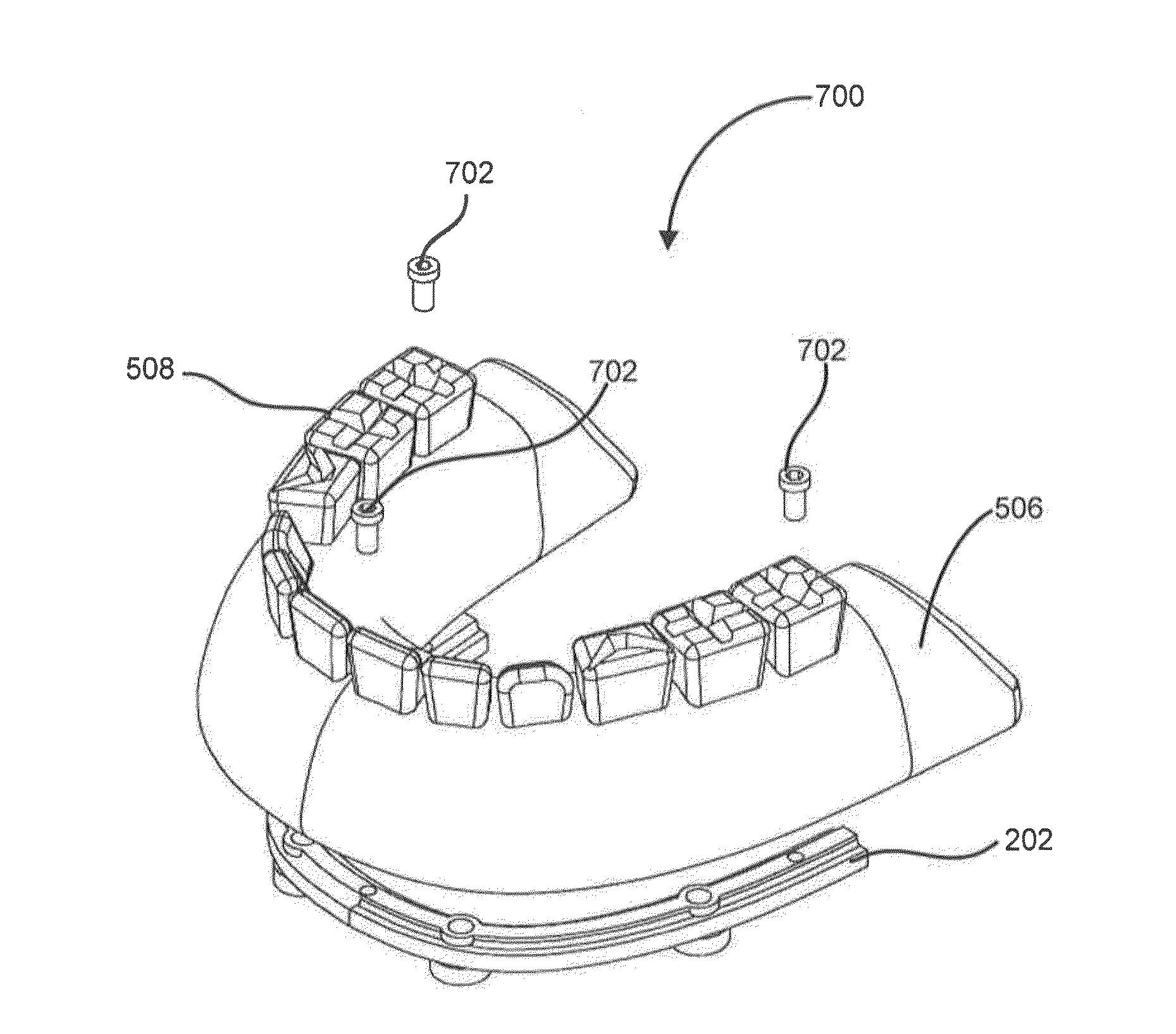 Denture Reference and Registration System