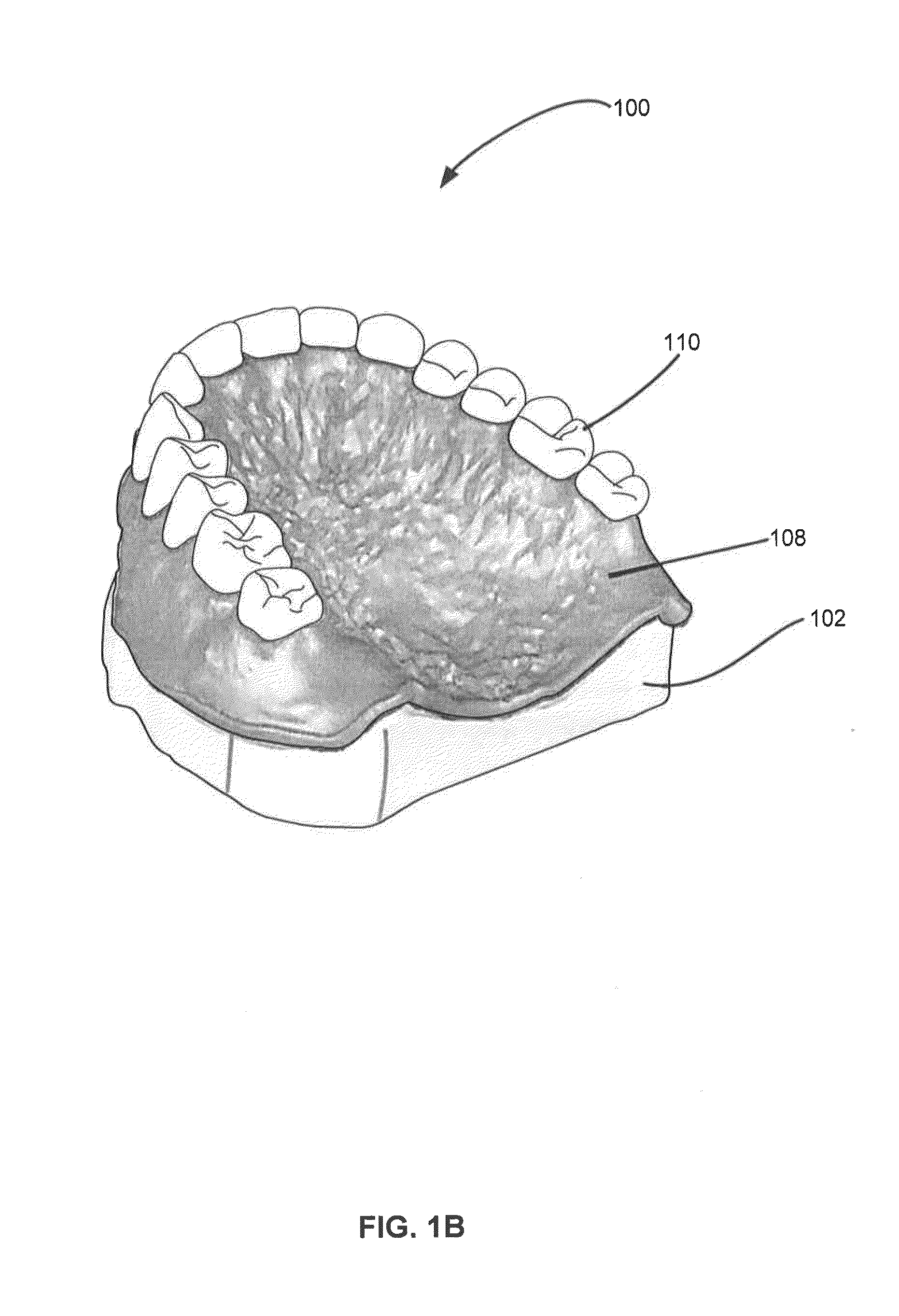 Denture Reference and Registration System