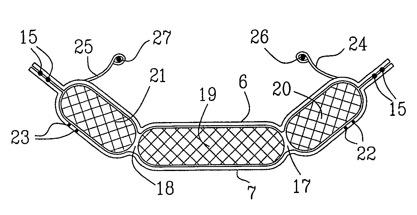 Absorbent article