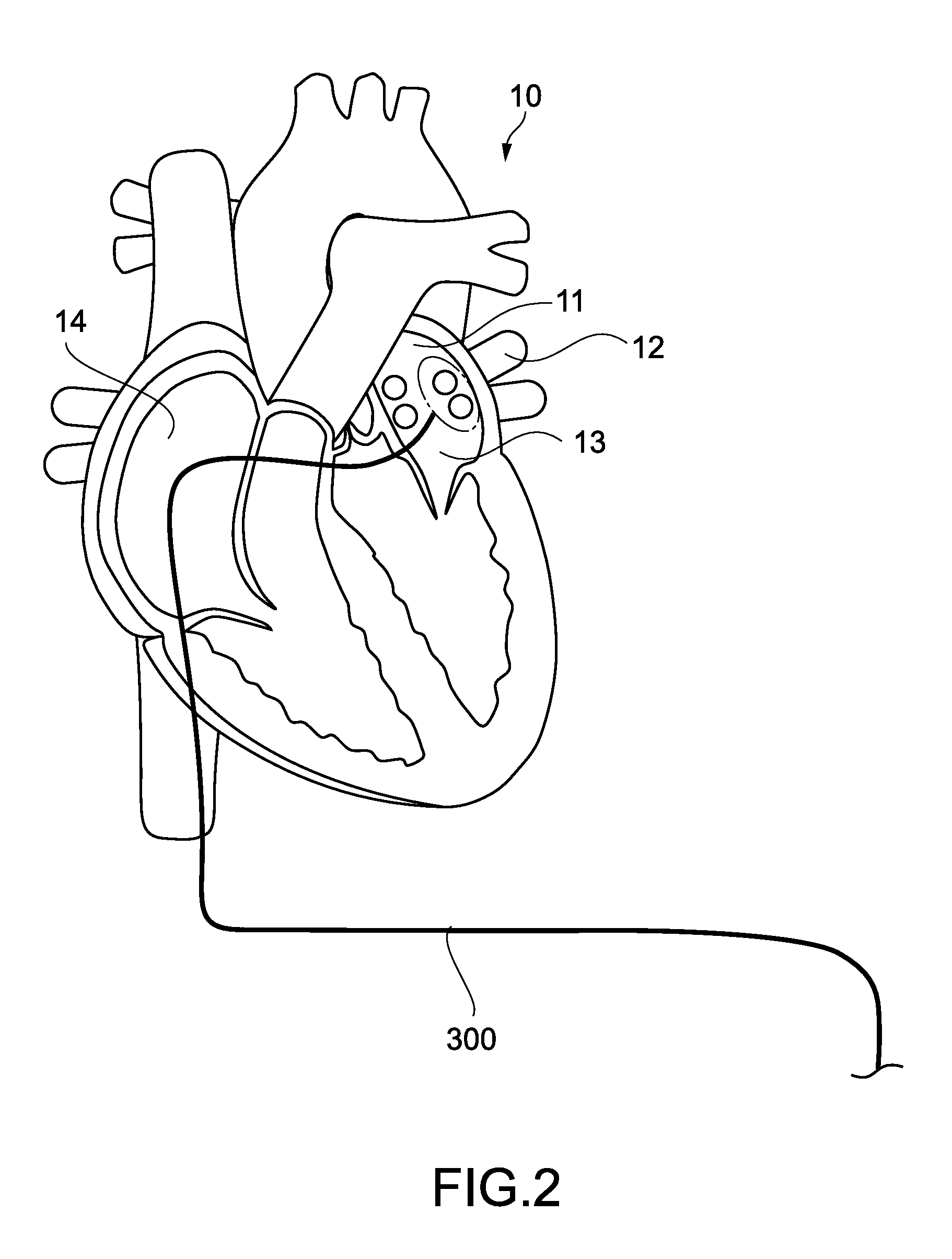 Laser therapy apparatus, laser therapy system, and determination method