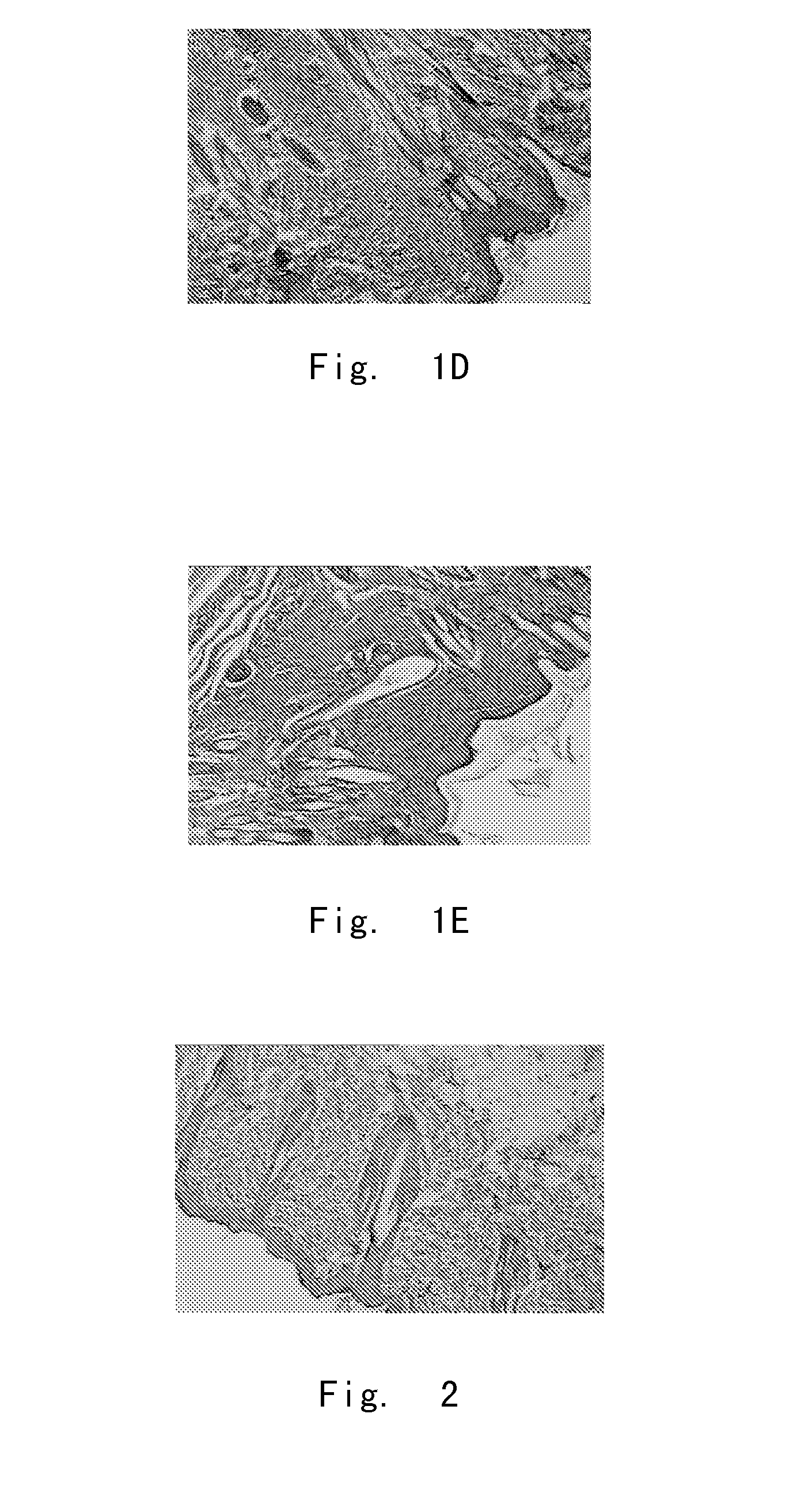 A use of hypertonic solution composition in manufacturing medicaments for promoting wound healing