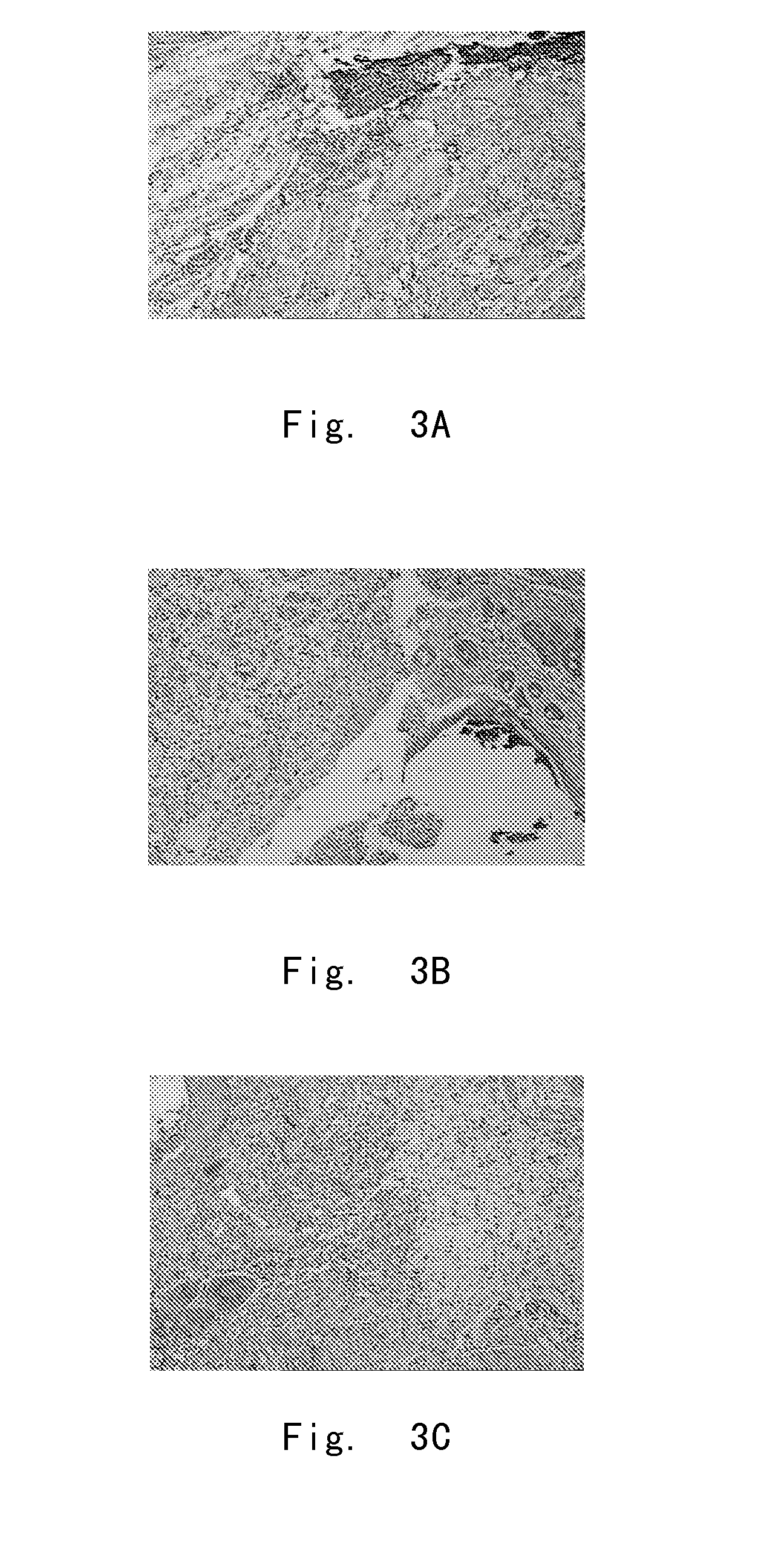 A use of hypertonic solution composition in manufacturing medicaments for promoting wound healing