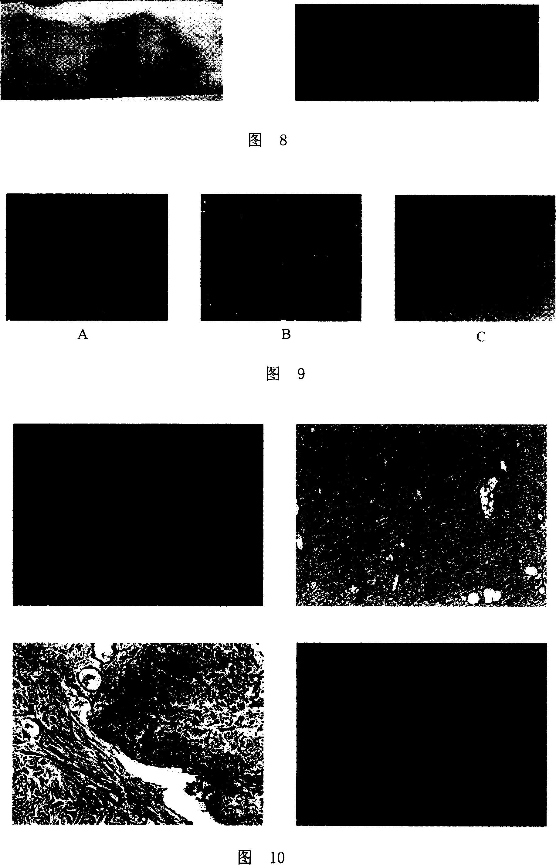 Acellular dermal matrix and its preparing method