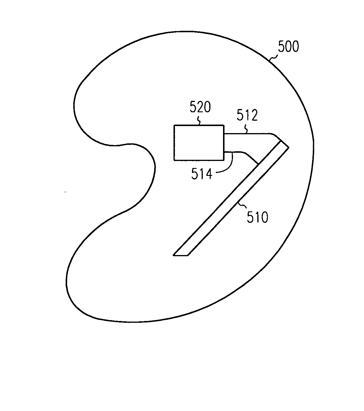 Antennas for hearing aids