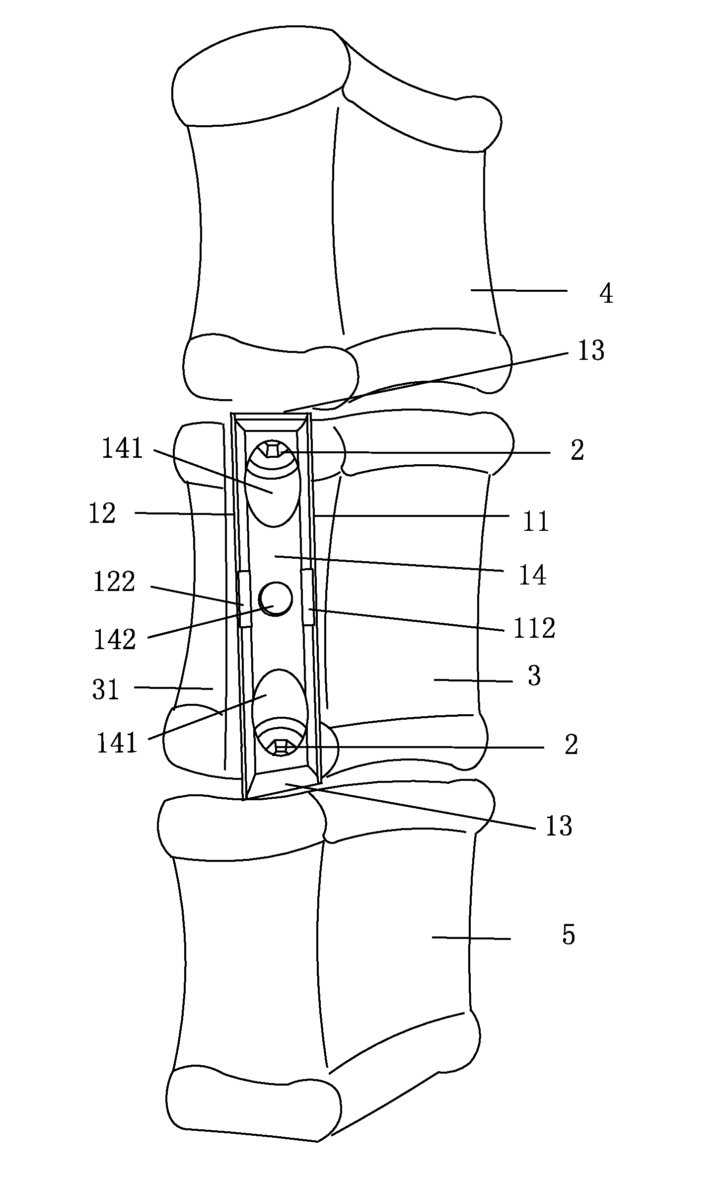 Interbody fusion device