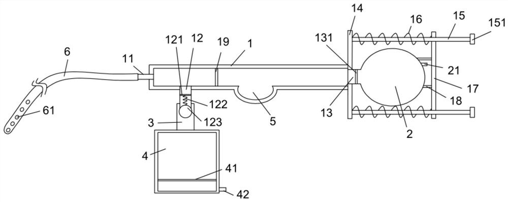 Gastrointestinal pressure reduction device for digestive system