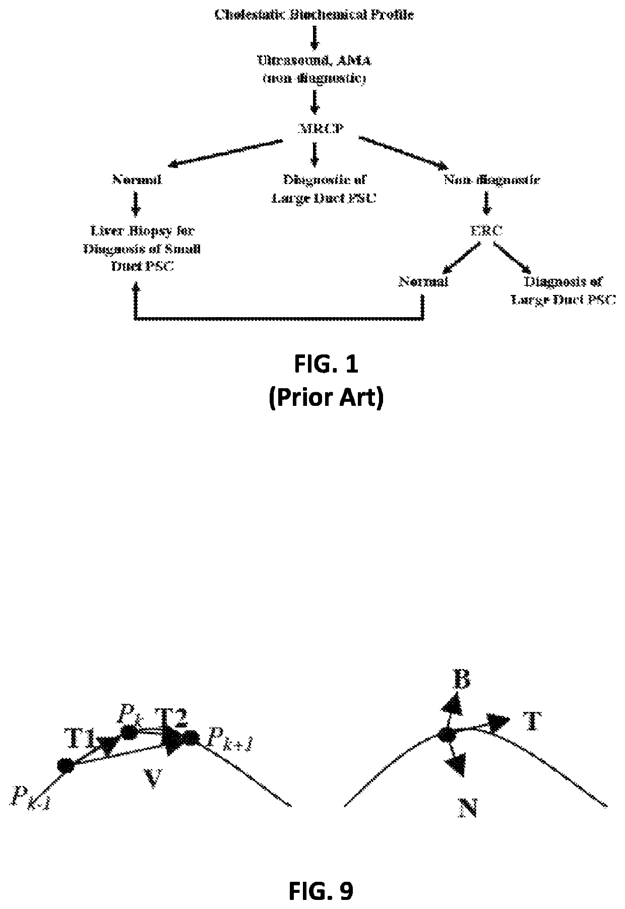 Method and apparatus for generating quantitative data for biliary tree structures