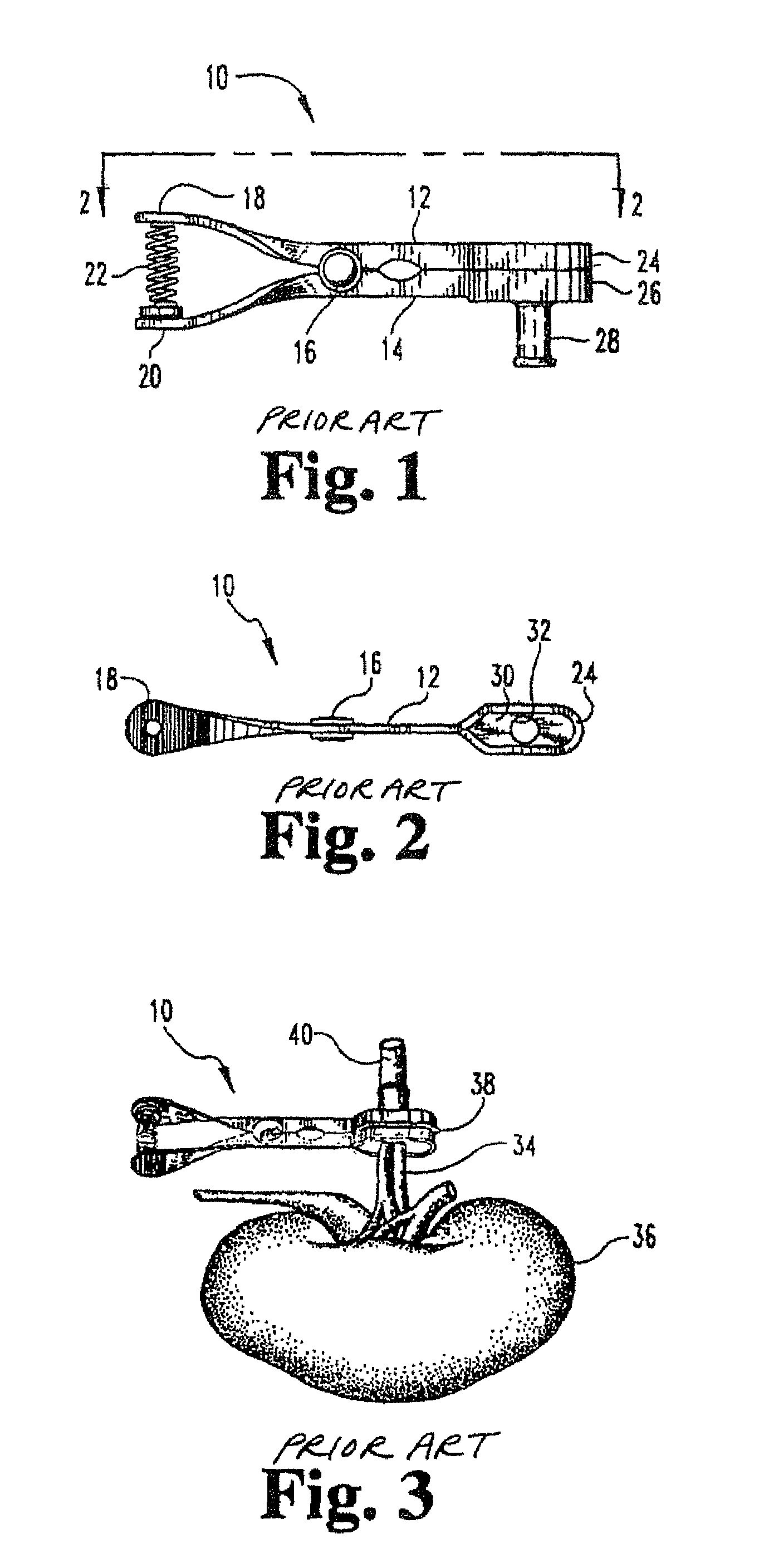 Universal sealring cannula