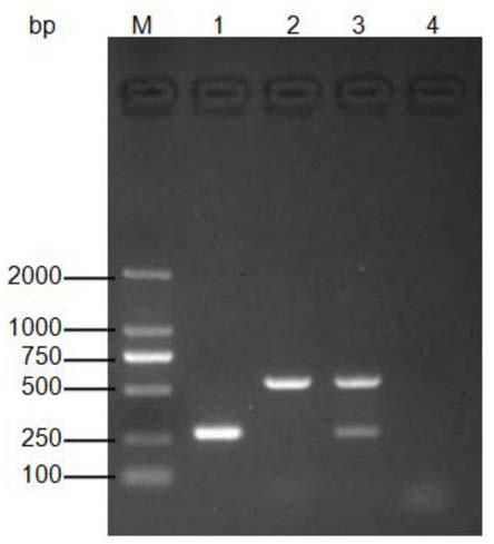 Primer set for detecting infectious spleen and kidney necrosis virus and siniperca chuatsi rhabdovirus and kit