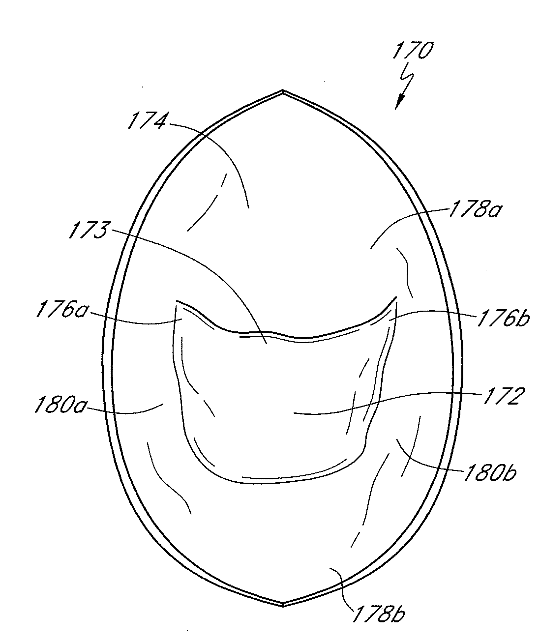 Biological valve for venous valve insufficiency