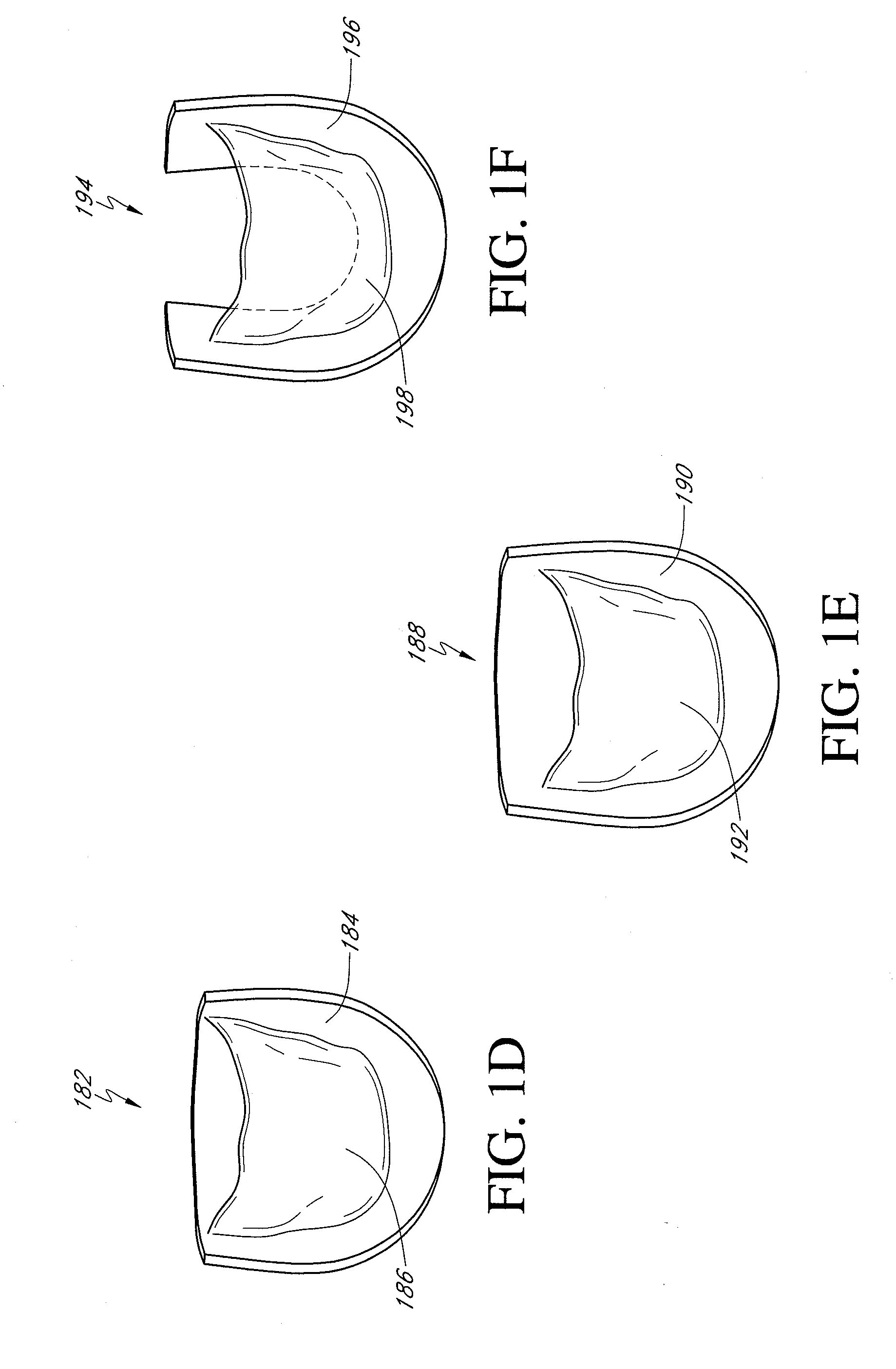 Biological valve for venous valve insufficiency