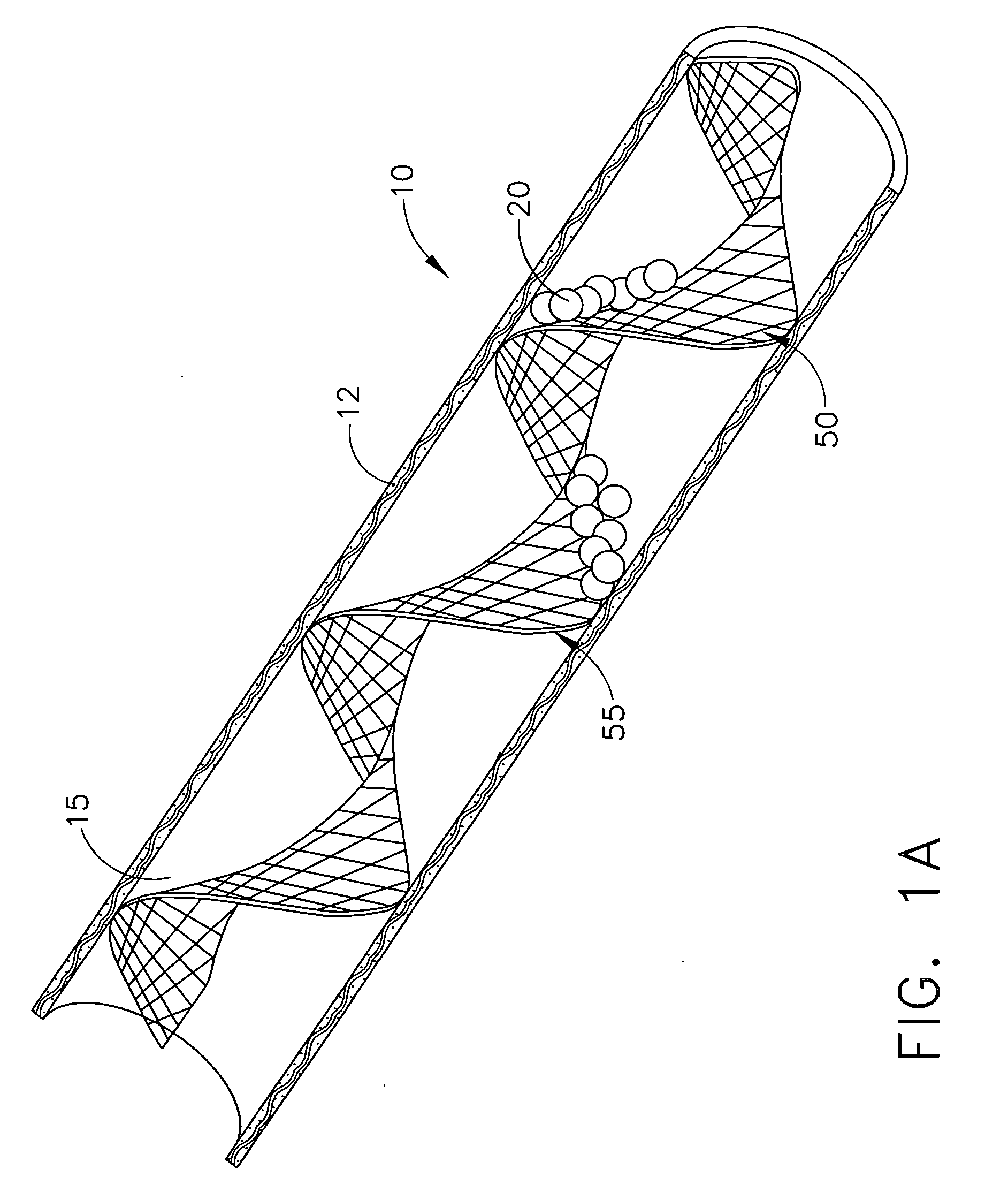 Method for filtering blood in a vessel with helical elements