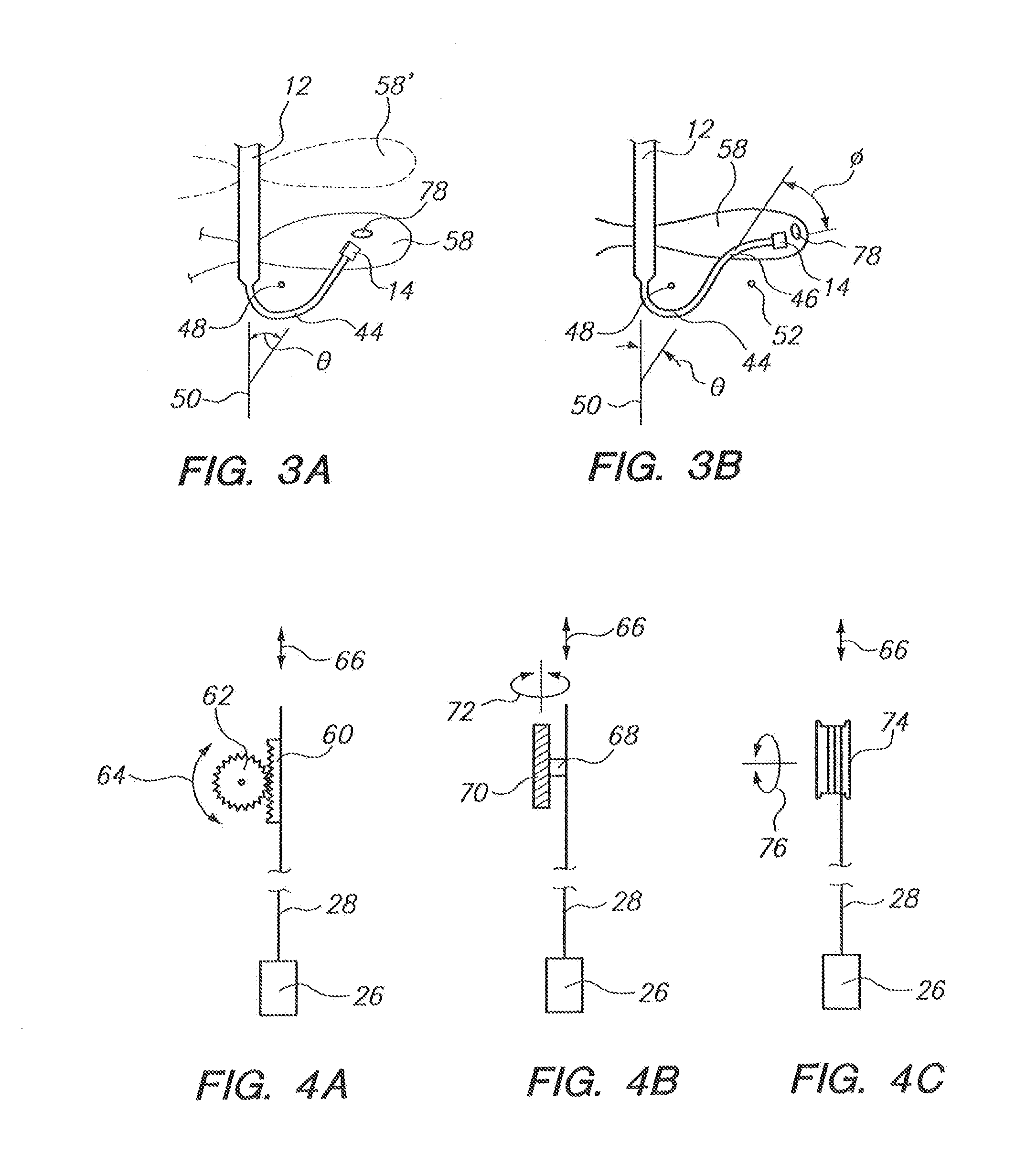 System and Method for Visualizing Catheter Placement in a Vasculature