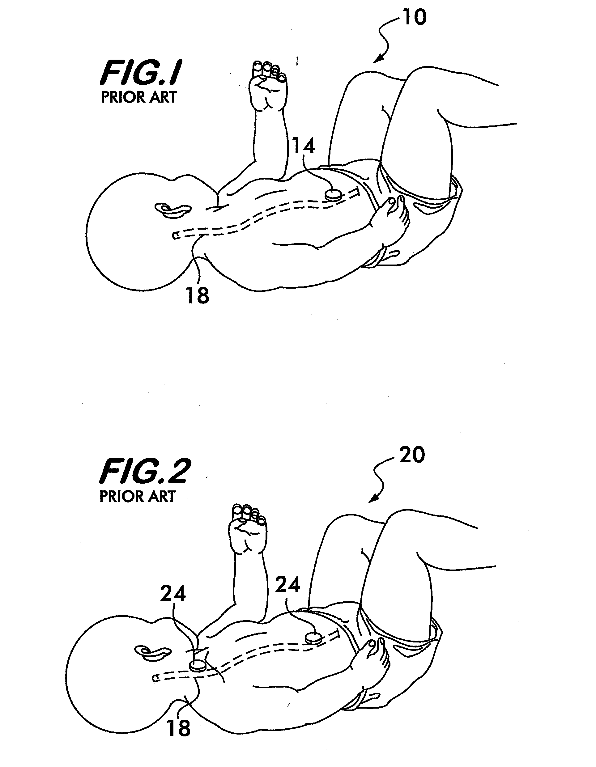 Cerebrospinal Fluid Evaluation Systems