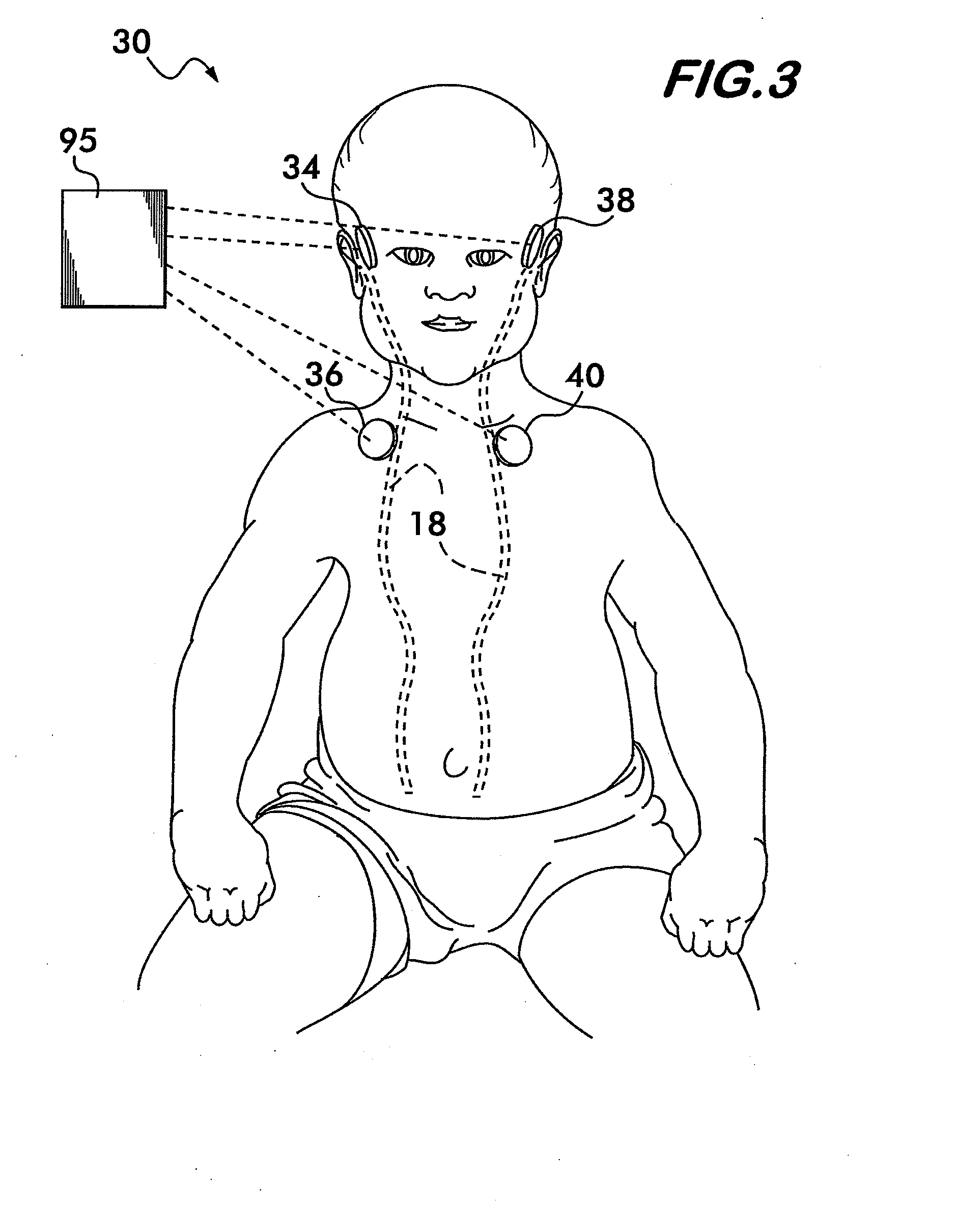 Cerebrospinal Fluid Evaluation Systems