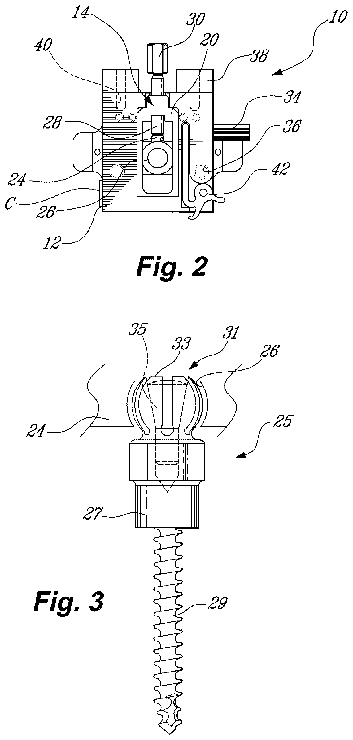 Method and system for planning/guiding alterations to a bone