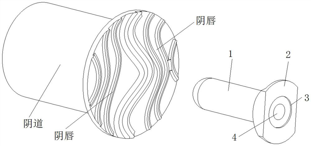 Knife edge positioner for female muscle ring tightening repair operation