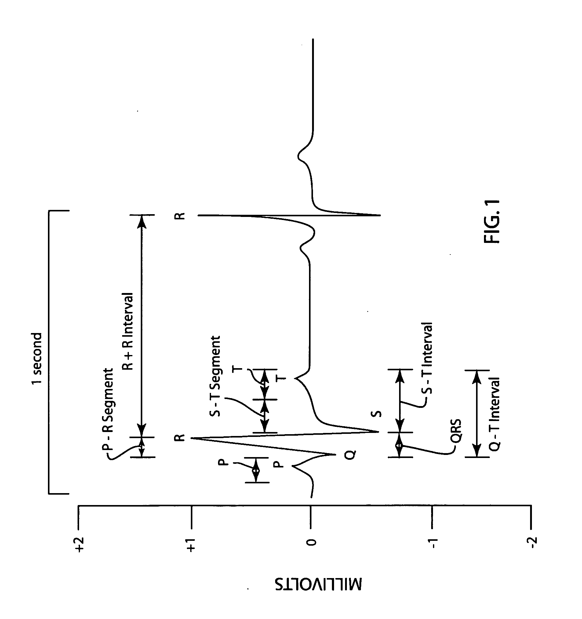 Method and apparatus for analyzing and editing ECG morphology and time series