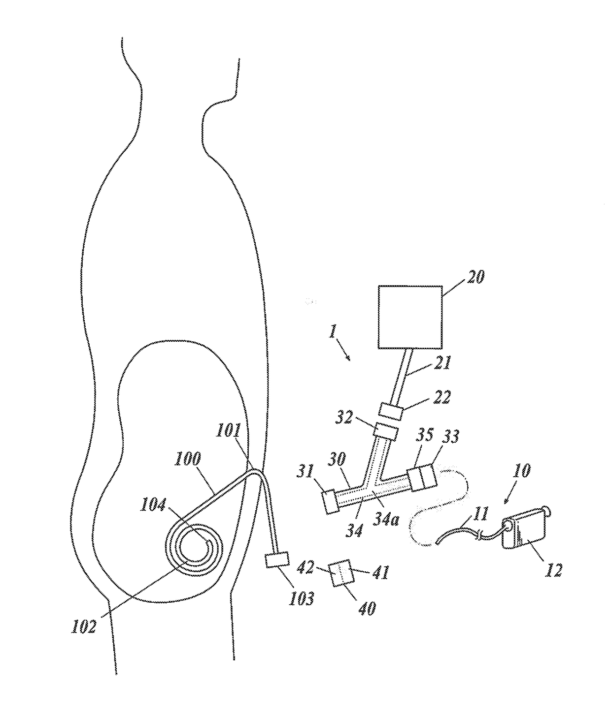 Laparoscopic device and endoscopic system