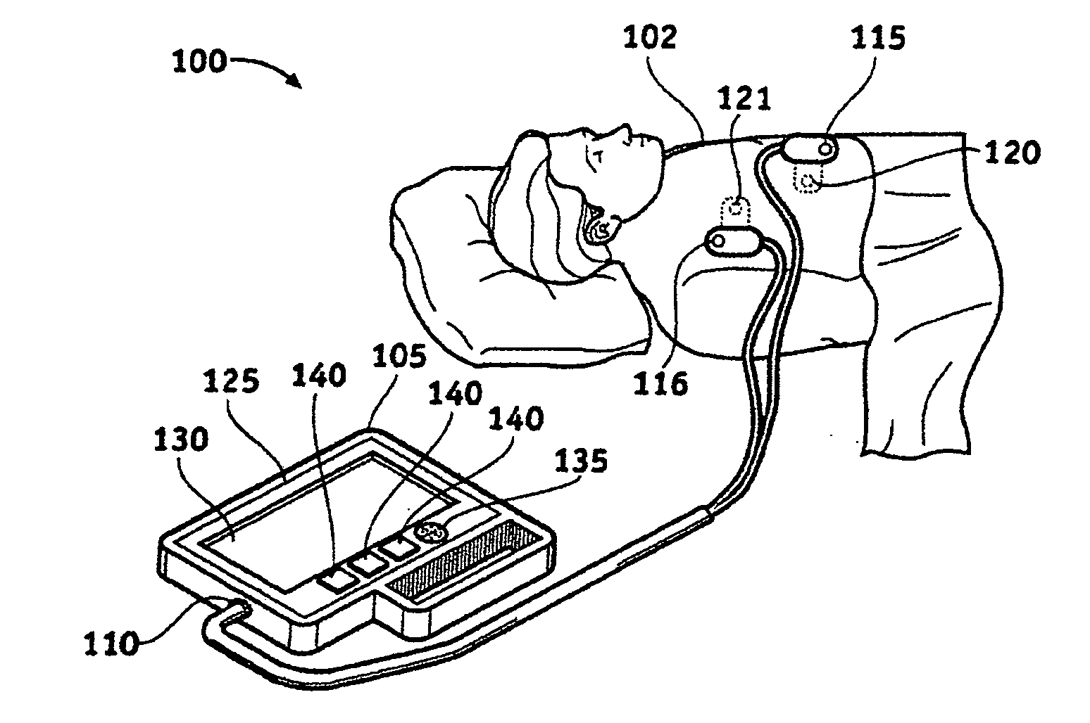 External Defibrillator With Adaptive Protocols